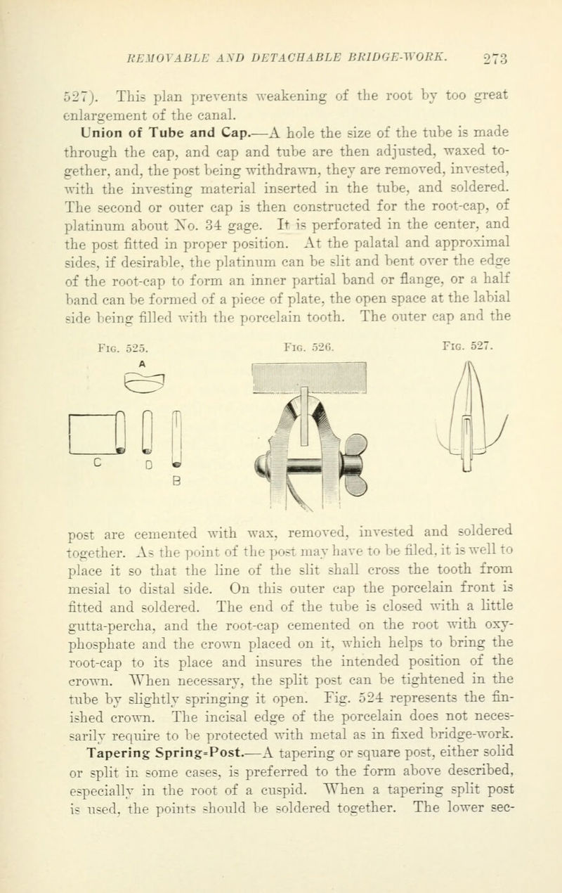 527). This plan prevents weakening of the root by too great enlargement of the canal. Union of Tube and Cap.—A hole the size of the tube is made through the cap, and cap and tube are then adjusted, waxed to- gether, and, the post being withdrawn, they are removed, invested, with the investing material inserted in the tube, and soldered. The second or outer cap is then constructed for the root-cap, of platinum about Xo. 34 gage. It is perforated in the center, and the post fitted in proper position. At the palatal and approximal sides, if desirable, the platinum can be slit and bent over the edge of the root-cap to form an inner partial band or flange, or a half band can be formed of a piece of plate, the open space at the labial side being filled with the porcelain tooth. The outer cap and the Fig. 526. Fig. 527. post are cemented with wax. removed, invested and soldered ther. As the point of the post may have to be filed, it is well to place it so that the line of the slit shall cross the tooth from mesial to distal side. On this outer cap the porcelain front is fitted and soldered. The end of the tube is closed with a little gutta-percha, and the root-cap cemented on the root with oxy- phosphate and the crown placed on it, which helps to bring the root-cap to its place and insures the intended position of the crown. When necessary, the split post can be tightened in the tube by slightly springing it open. Fig. 524 represents the fin- ished crown. The incisal edge of the porcelain does not neces- sarily require to be protected with metal as in fixed bridge-work. Tapering Spring=Post.—A tapering or square post, either solid or split in some cases, is preferred to the form above described, especially in the root of a cuspid. When a tapering split post is used, the points should be soldered together. The lower sec-