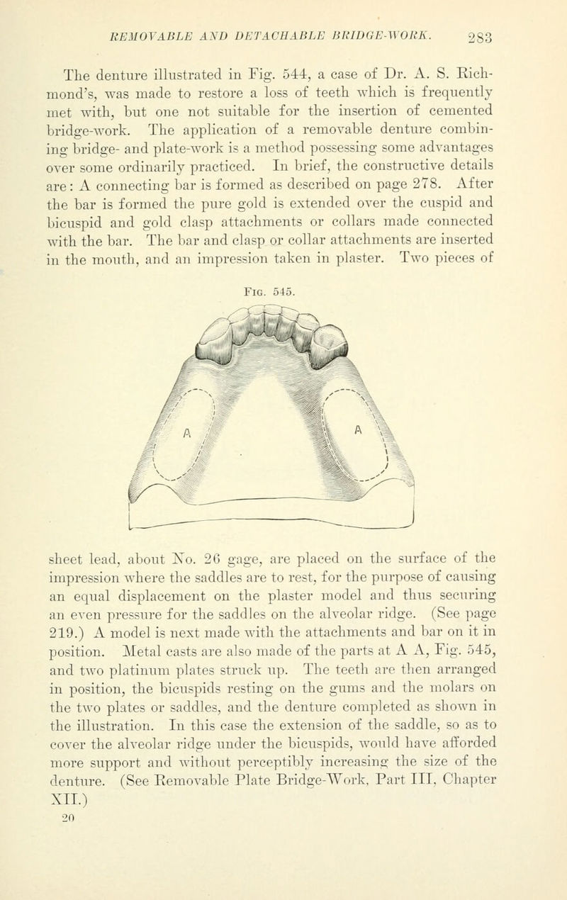 The denture illustrated in Fig. 544, a case of Dr. A. S. Rich- mond's, was made to restore a loss of teeth which is frequently met with, but one not suitable for the insertion of cemented bridge-work. The application of a removable denture combin- ing bridge- and plate-work is a method possessing some advantages over some ordinarily practiced. In brief, the constructive details are: A connecting bar is formed as described on page 278. After the bar is formed the pure gold is extended over the cuspid and bicuspid and gold clasp attachments or collars made connected with the bar. The bar and clasp or collar attachments are inserted in the mouth, and an impression taken in plaster. Two pieces of Fig. 545. sheet lead, about Xo. 26 gage, are placed on the surface of the impression where the saddles are to rest, for the purpose of causing an equal displacement on the plaster model and thus securing an even pressure for the saddles on the alveolar ridge. (See page 219.) A model is next made with the attachments and bar on it in position. Metal casts are also made of the parts at A A, Fig. 545, and two platinum plates struck up. The teeth are then arranged in position, the bicuspids resting on the gums and the molars on the two plates or saddles, and the denture completed as shown in the illustration. In this case the extension of the saddle, so as to cover the alveolar ridge under the bicuspids, would have afforded more support and without perceptibly increasing the size of the denture. (See Removable Plate Bridge-Work, Part III, Chapter XII.) 20