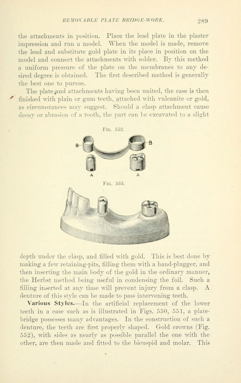 the attachments in position. Place the lead plate in the plaster impression and run a model. When the model is made, remove the lead and substitute gold plate in its place in position on the model and connect the attachments with solder. By this method a uniform pressure of the plate on the membranes to any de- sired degree is obtained. The first described method is generally the best one to pursue. The plate tand attachments having been united, the case is then finished with plain or gum teeth, attached with vulcanite or gold, as circumstances may suggest. Should a clasp attachment cause decay or abrasion of a tooth, the part can be excavated to a slight Fig. 552. depth under the clasp, and tilled with gold. This is best done by making a few retaining-pits, filling them with a hand-plugger, and then inserting the main body of the gold in the ordinary manner, the Herbst method being useful in condensing the foil. Such a filling inserted at any time will prevent injury from a clasp. A denture of this style can be made to pass intervening teeth. Various Styles.-—In the artificial replacement of the lower teeth in a case such as is illustrated in Figs. 550, 551, a plate- bridge possesses many advantages. In the construction of such a denture, the teeth are first properly shaped. Gold crowns (Fig. 552), with sides as nearly as possible parallel the one with the other, are then made and fitted to the bicuspid and molar. This