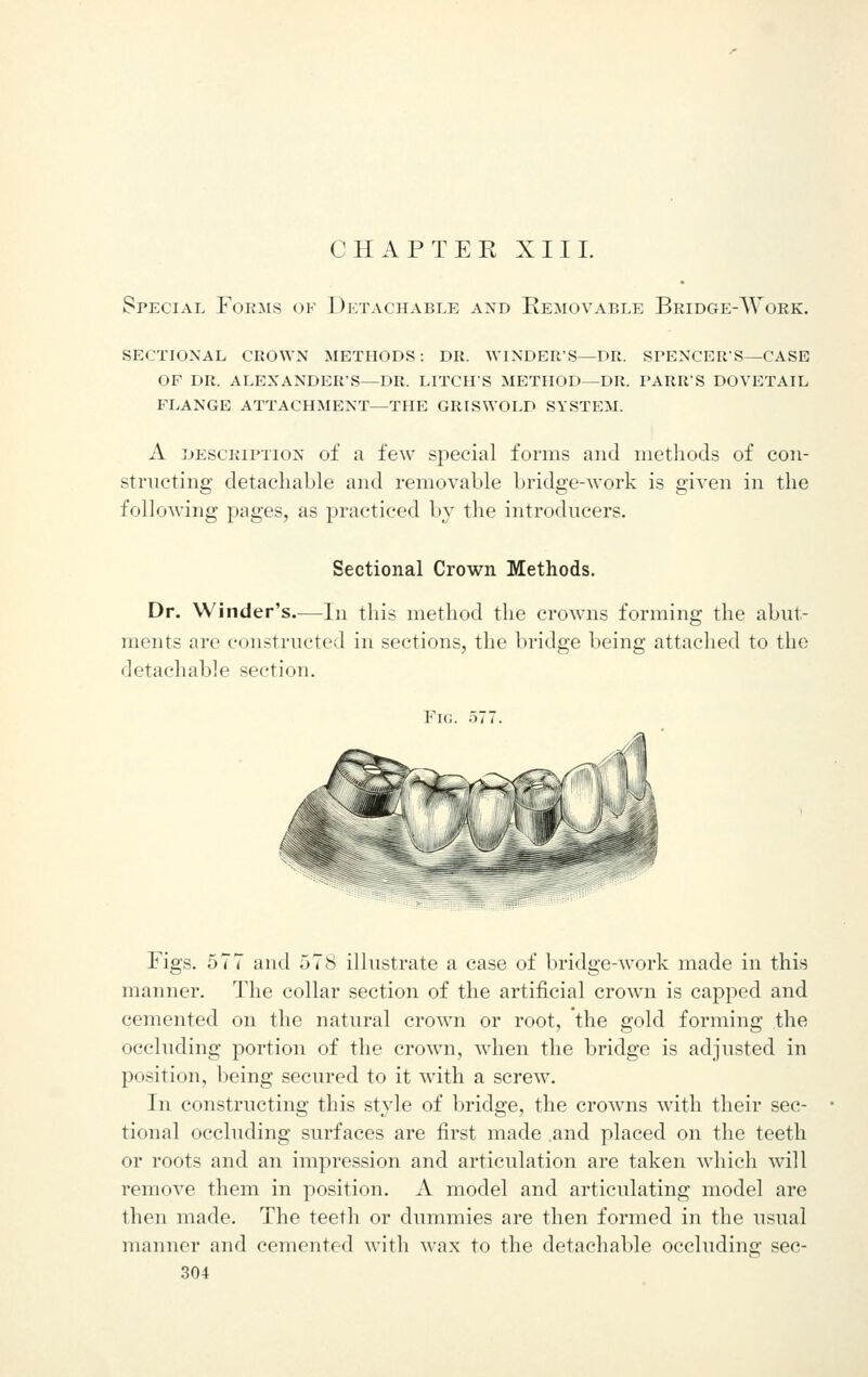 CHAP TEE XIII. Special Forms of Detachable and Removable Bridge-Work. sectional crown methods: dr. winder's—dr. spencer's—case of dr. alexander's—dr. litch's method—dr. parrs dovetail flange attachment—the griswold system. A description of a few special forms and methods of con- structing detachable and removable bridge-work is given in the following pages, as practiced by the introducers. Sectional Crown Methods. Dr. Winder's.—In this method the crowns forming the abut- ments are constructed in sections, the bridge being attached to the detachable section. Fig. 577. Figs. 577 and 578 illustrate a case of bridge-work made in this manner. The collar section of the artificial crown is capped and cemented on the natural crown or root, the gold forming the occluding portion of the crown, when the bridge is adjusted in position, being secured to it with a screw. In constructing this style of bridge, the crowns with their sec- tional occluding surfaces are first made .and placed on the teeth or roots and an impression and articulation are taken which will remove them in position. A model and articulating model are then made. The teeth or dummies are then formed in the usual manner and cemented with wax to the detachable occluding sec-