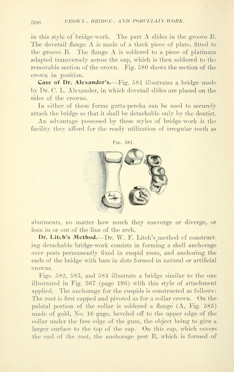 in this style of bridge-work. The part A slides in the groove B. The dovetail flange A is made of a thick piece of plate, fitted to the groove B. The flange A is soldered to a piece of platinum adapted transversely across the cap, which is then soldered to the removable section of the crown. Fig. 580 shows the section of the crown in position. Case of Dr. Alexander's.—Fig. 581 illustrates a bridge made by Dr. C. L. Alexander, in which dovetail slides are placed on the sides of the crowns. In either of these forms gutta-percha can be used to securely attach the bridge so that it shall be detachable only by the dentist. An advantage possessed by these styles of bridge-work is the facility they afford for the ready utilization of irregular teeth as Fig. 581. abutments, no matter how much they converge or diverge, or lean in or out of the line of the arch. Dr. Litch's Method.—Dr. W. F. Litch's .method of construct- ing detachable bridge-work consists in forming a shell anchorage over posts permanently fixed in cuspid roots, and anchoring the ends of the bridge with bars in slots formed in natural or artificial crowns. Figs. 582, 583, and 584 illustrate a bridge similar to the one illustrated in Fig. 367 (page 196) with this style of attachment applied. The anchorage for the cuspids is constructed as follows: The root is first capped and pivoted as for a collar crown. On the palatal portion of the collar is soldered a flange (A, Fig. 585) made of gold, No. 16 gage, beveled off to the upper edge of the collar under the free edge of the gum, the object being to give a larger surface to the top of the cap. On this cap, which covers the end of the root, the anchorage post B, which is formed of