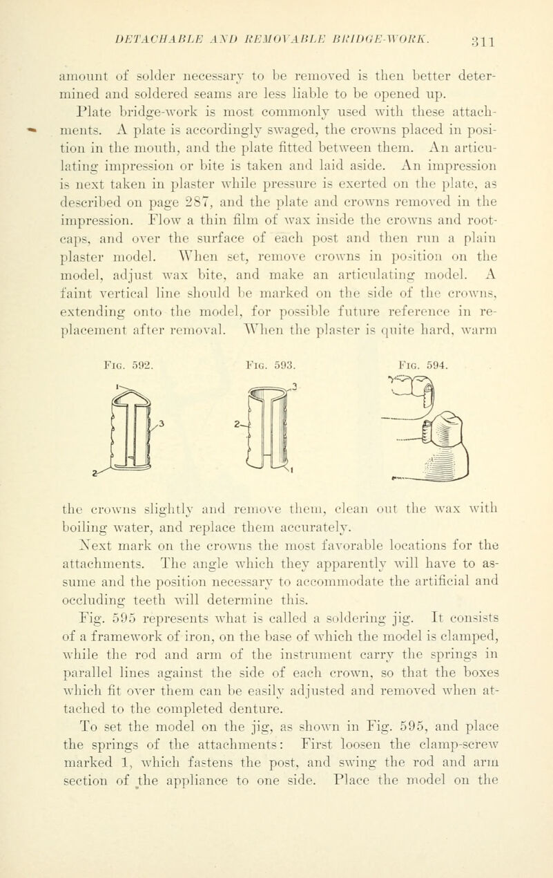 amount of solder necessary to be removed is then better deter- mined and soldered seams are less liable to be opened up. Plate bridge-work is most commonly used with these attach ments. A plate is accordingly swaged, the crowns placed in posi- tion in the month, and the plate fitted between them. An articu- lating impression or bite is taken and laid aside. An impression is next taken in plaster while pressure is exerted on the plate, as described on page 287, and the plate and crowns removed in the impression. Flow a thin film of wax inside the crowns and root- caps, and over the surface of each post and then run a plain plaster model. When set, remove crowns in position on the model, adjust wax bite, and make an articulating model. A faint vertical line should be marked on the side of the crown-, extending onto the model, for possible future reference in re- placement after removal. When the plaster is quite hard, warm Fig. 592. Fig. 594. the crowns slightly and remove them, clean out the wax with boiling water, and replace them accurately. Next mark on the crowns the most favorable locations for the attachments. The angle which they apparently will have to as- sume and the position necessary to accommodate the artificial and occluding teeth will determine this. Fig. 595 represents what is called a soldering jig. It consists of a framework of iron, on the base of which the model is clamped, while the rod and arm of the instrument carry the springs in parallel lines against the side of each crown, so that the boxes which fit over them can be easily adjusted and removed when at- tached to the completed denture. To set the model on the jig, as shown in Fig. 595, and place the springs of the attachments: First loosen the clamp-screw marked 1, which fastens the post, and swing the rod and arm section of vthe appliance to one side. Place the model on the