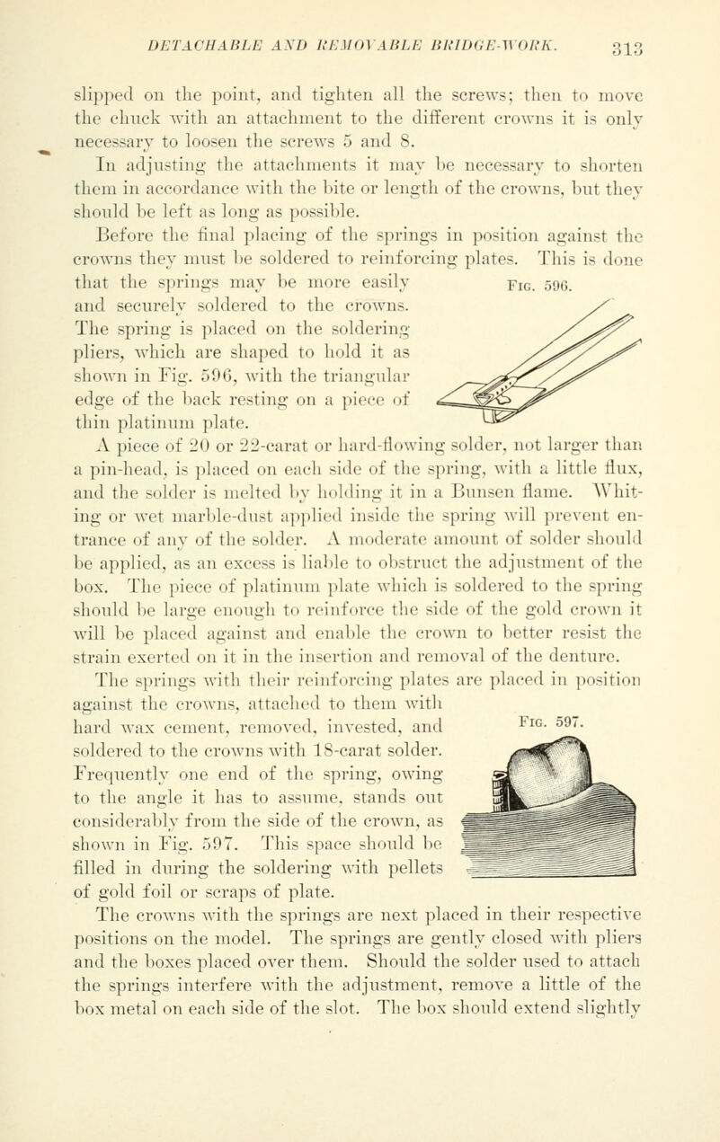 slipped on the point, and tighten all the screws; then to move the chuck with an attachment to the different crowns it is only necessary to loosen the screws 5 and 8. In adjusting the attachments it may he necessary to shorten them in accordance with the bite or length of the crowns, but they should be left as long as possible. Before the final placing of the springs in position against the crowns they must be soldered to reinforcing plates. This is done that the springs may be more easily fig. 596. and securely soldered to the crown-. The spring is placed on the soldering pliers, which are shaped to hold it as shown in Fig. 596, with the triangular edge of the back resting on a piece of thin platinum plate. A piece of 20 or 22-carat or hard-flowing solder, not larger than a pin-head, is placed on each side of the spring, with a little flux, and the solder is melted by holding it in a Bunsen flame. Whit- ing or wet marble-dust applied inside the spring will prevent en- trance of any of the solder. A moderate amount of solder should be applied, as an excess is liable to obstruct the adjustment of the box. The piece of platinum plate which is soldered to the spring should be large enough to reinforce the side of the gold crown it will be placed against and enable the crown to better resist the strain exerted on it in the insertion and removal of the denture. The springs with their reinforcing plates are placed in position against the crowns, attached to them with hard wax cement, removed, invested, and soldered to the crowns with 18-carat solder. Frequently one end of the spring, owing to the angle it has to assume, stands out considerably from the side of the crown, as shown in Fig. r>97. This space should be filled in during the soldering with pellets of gold foil or scraps of plate. The crowns with the springs are next placed in their respective positions on the model. The springs are gently closed with pliers and the boxes placed over them. Should the solder used to attach the springs interfere with the adjustment, remove a little of the box metal on each side of the slot. The box should extend slightly Fig