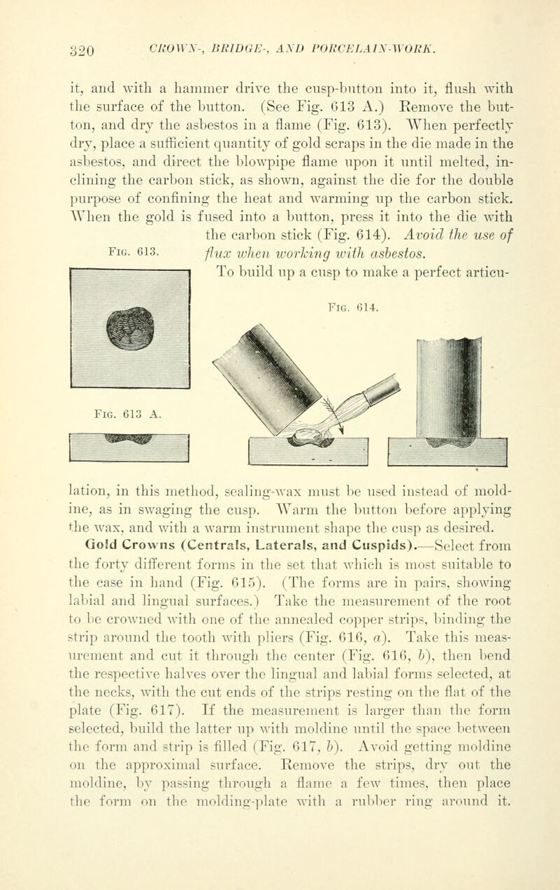 it, and with a hammer drive the cusp-button into it, flush with the surface of the button. (See Fig. 613 A.) Remove the but- ton, and dry the asbestos in a flame (Fig. 613). When perfectly dry, place a sufficient quantity of gold scraps in the die made in the asbestos, and direct the blowpipe flame upon it until melted, in- clining the carbon stick, as shown, against the die for the double purpose of confining the heat and warming up the carbon stick. When the gold is fused into a button, press it into the die wTith the carbon stick (Fig. 614). Avoid the use of Fig. 613. ffux when working with asbestos. To build up a cusp to make a perfect articu- Fig. 614. Fig. 613 A. lation, in this method, sealing-wax must be used instead of mold- ine, as in swaging the cusp. Warm the button before applying the wax, and with a warm instrument shape the cusp as desired. Go!d Crowns (Centrals, Laterals, and Cuspids).—Select from the forty different forms in the set that which is most suitable to the case in hand (Fig. 615). (The forms are in pairs, showing labial and lingual surfaces.) Take the measurement of the root to lie crowned with one of the annealed copper strips, binding the strip around the tooth with pliers (Fig. 616, a). Take this meas- urement and cut it through the center (Fig. 616, b), then bend the respective halves over the lingual and labial forms selected, at the necks, with the cut ends of the strips resting on the flat of the plate (Fig. 617). If the measurement is larger than the form selected, build the latter up with moldine until the space between the form and strip is filled (Fig. 617, b). Avoid getting moldine on the approximal surface. Remove the strips, dry out the moldine, by passing through a flame a few times, then place the form on the molding-plate with a rubber ring around it.