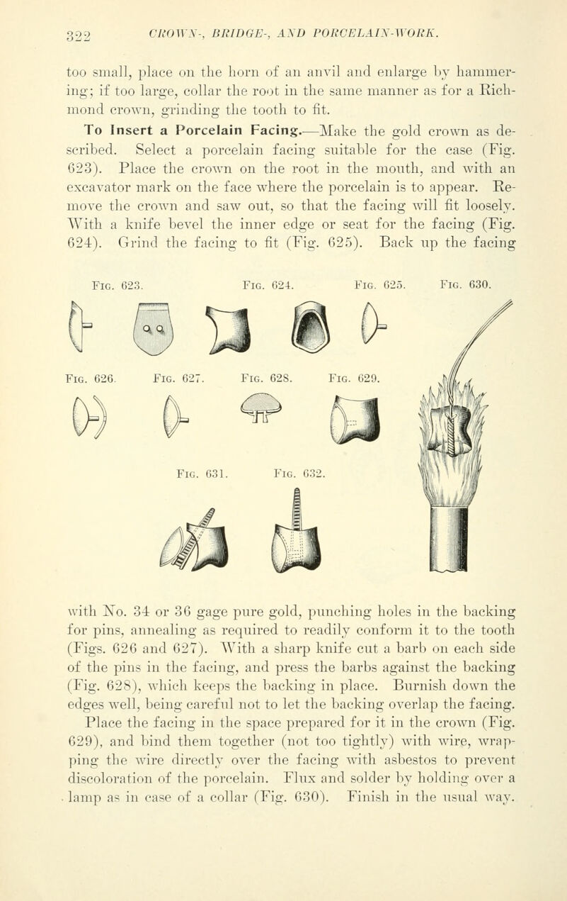 too small, place on the horn of an anvil and enlarge by hammer- ing; if too large, collar the root in the same manner as for a Rich- mond crown, grinding the tooth to fit. To Insert a Porcelain Facing.—Make the gold crown as de- scribed. Select a porcelain facing suitable for the case (Fig. 623). Place the crown on the root in the month, and with an excavator mark on the face where the porcelain is to appear. Re- move the crown and saw out, so that the facing will fit loosely. With a knife bevel the inner edge or seat for the facing (Fig. 624). Grind the facing to fit (Fig. 625). Back up the facing Fig. 623. Fig. 624. Fig. 625. Fig. 630. Fig. 626. Fig. 627. Fig. 62S. Fig. 629. h/L Fig. 631. Fig. 632. with No. 34 or 36 gage pure gold, punching holes in the backing for pins, annealing as required to readily conform it to the tooth (Figs. 626 and 627). With a sharp knife cut a barb on each side of the pins in the facing, and press the barbs against the backing (Fig. 628), which keeps the backing in place. Burnish down the edges well, being careful not to let the backing overlap the facing. Place the facing in the space prepared for it in the crown (Fig. 629), and bind them together (not too tightly) with wire, wrap- ping the wire directly over the facing with asbestos to prevent discoloration of the porcelain. Flux and solder by holding over a lamp as in case of a collar (Fig. 630). Finish in the usual way.