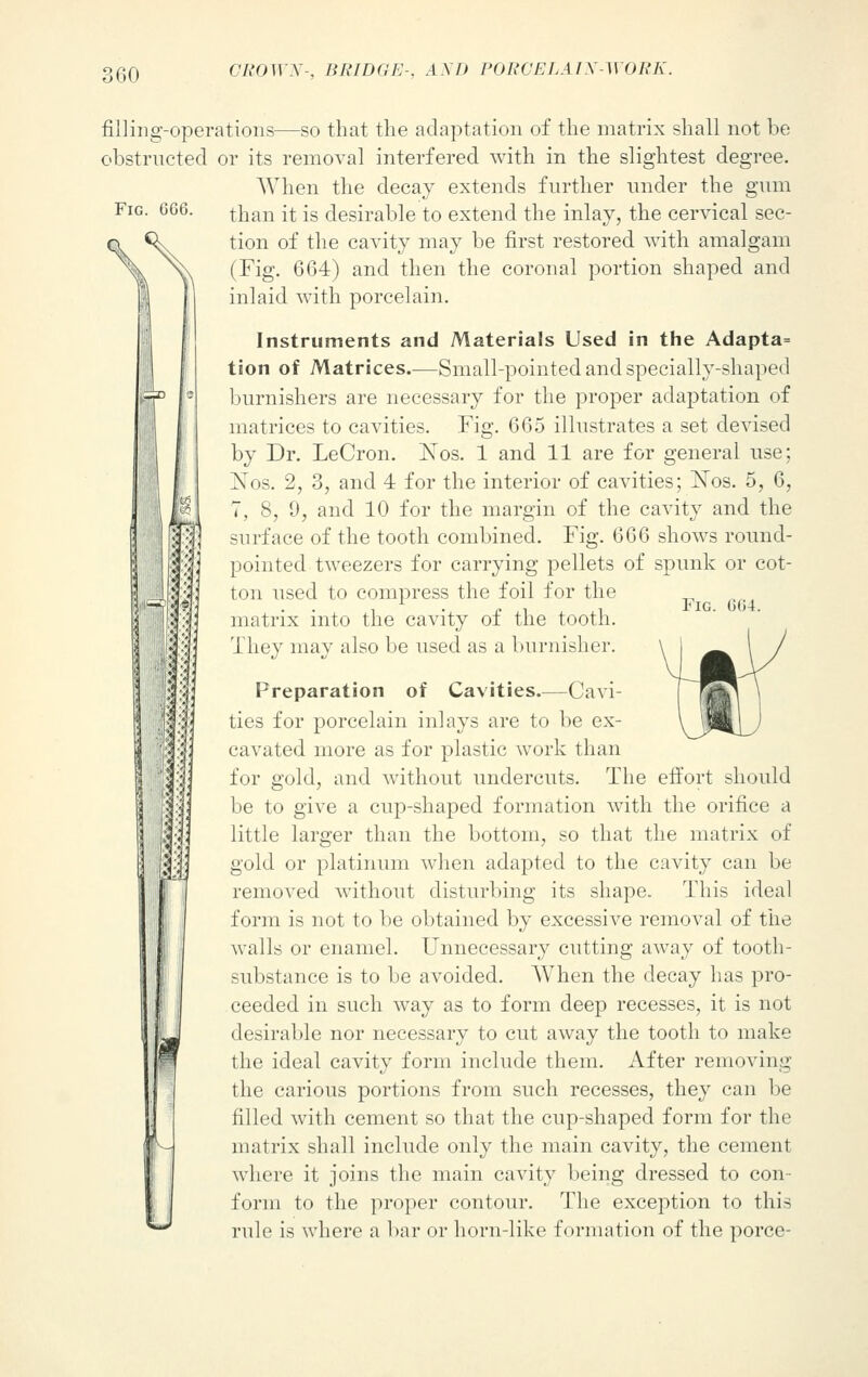 Fig. GG6. filling-operations—so that the adaptation of the matrix shall not be obstructed or its removal interfered with in the slightest degree. When the decay extends further under the gum than it is desirable to extend the inlay, the cervical sec- tion of the cavity may be first restored with amalgam (Fig. 664) and then the coronal portion shaped and inlaid with porcelain. Instruments and Materials Used in the Adapta= tion of Matrices.—Small-pointed and specially-shaped burnishers are necessary for the proper adaptation of matrices to cavities. Fig. 665 illustrates a set devised by Dr. LeCron. ISTos. 1 and 11 are for general use; NTos. 2, 3, and 4 for the interior of cavities; Nos. 5, 6, 7, 8, 9, and 10 for the margin of the cavity and the surface of the tooth combined. Fig. 666 shows round- pointed tweezers for carrying pellets of spunk or cot- ton used to compress the foil for the o:h matrix into the cavity of the tooth. They may also be used as a burnisher. Fig. 604. Preparation of Cavities.—Cavi- ties for porcelain inlays are to be ex- cavated more as for plastic work than for gold, and without undercuts. The effort should be to give a cup-shaped formation with the orifice a little larger than the bottom, so that the matrix of gold or platinum when adapted to the cavity can be removed without disturbing its shape. This ideal form is not to be obtained by excessive removal of the walls or enamel. Unnecessary cutting away of tooth- substance is to be avoided. When the decay has pro- ceeded in such way as to form deep recesses, it is not desirable nor necessary to cut away the tooth to make the ideal cavity form include them. After removing the carious portions from such recesses, they can be filled with cement so that the cup-shaped form for the matrix shall include only the main cavity, the cement where it joins the main cavity being dressed to con- form to the proper contour. The exception to this rule is where a bar or horn-like formation of the porce-
