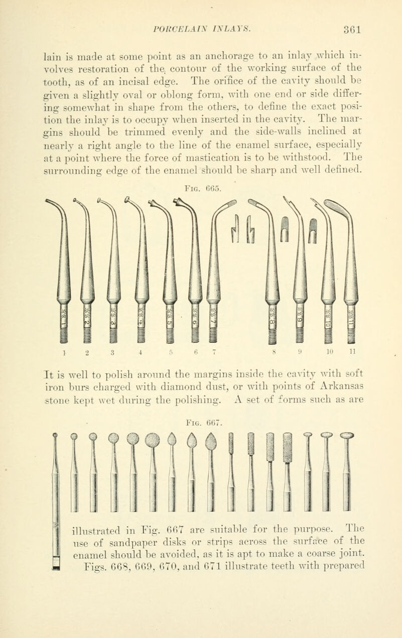 lain is made at some point as an anchorage to an inlay which in- volves restoration of the. contour of the working surface of the tooth, as of an incisal edge. The orifice of the cavity should be given a slightly oval or oblong form, with one end or side differ- ing somewhat in shape from the others, to define the exact posi- tion the inlay is to occupy when inserted in the cavity. The mar- gins should be trimmed evenly and the side-walls inclined at nearly a right angle to the line of the enamel surface, especially at a point where the force of mastication is to be withstood. The surrounding edge of the enamel should be sharp and well defined. Fig. GG5. It is well to polish around the margins inside the cavity with soft iron burs charged with diamond dust, or with points of Arkansas stone kept wet during the polishing. A set of forms such as are Fig. 607, illustrated in Fig. 66V are suitable for the purpose. The use of sandpaper disks or strips across the surface of the J enamel should be avoided, as it is apt to make a coarse joint. Figs. 663, 669, 670, and 671 illustrate teeth with prepared
