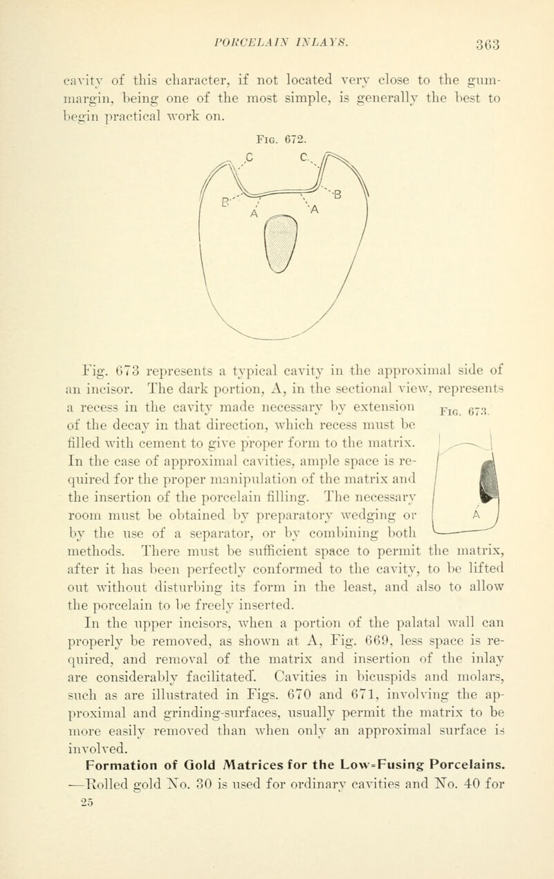 cavity of this character, if not located very close to the gum- margin, being one of the most simple, is generally the best to begin practical work on. Fig. 672. C C, Fig. 673 represents a typical cavity in the approximal side of an incisor. The dark portion, A, in the sectional view, represents a recess in the cavity made necessary by extension FlG 673 of the decay in that direction, which recess must be filled with cement to give proper form to the matrix. In the case of approximal cavities, ample space is re- quired for the proper manipulation of the matrix and the insertion of the porcelain filling. The necessary room must be obtained by preparatory wedging or by the use of a separator, or by combining both methods. There must be sufficient space to permit the matrix, after it has been perfectly conformed to the cavity, to be lifted out without disturbing its form in the least, and also to allow the porcelain to be freely inserted. In the upper incisors, when a portion of the palatal wall can properly be removed, as shown at A, Fig. 669, less space is re- quired, and removal of the matrix and insertion of the inlay are considerably facilitated'. Cavities in bicuspids and molars, such as are illustrated in Figs. 670 and 671, involving the ap- proximal and grinding-surfaces, usually permit the matrix to be more easily removed than when only an approximal surface is involved. Formation of Gold Matrices for the Lo\v=Fusing Porcelains. —Rolled gold No. 30 is used for ordinary cavities and No. 40 for 25
