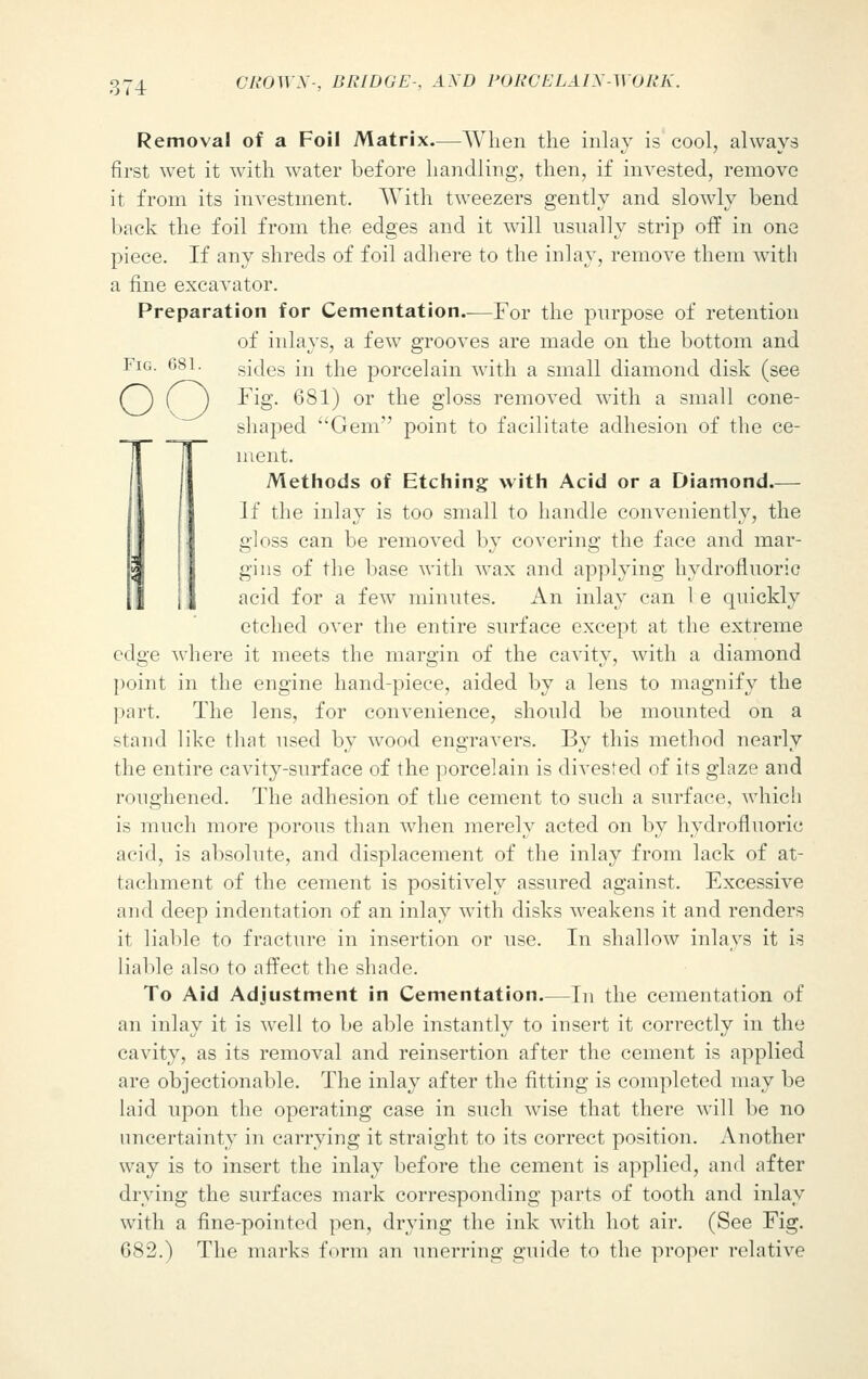 Removal of a Foil Matrix.—When the inlay is cool, always first wet it with water before handling, then, if invested, remove it from its investment. With tweezers gently and slowly bend back the foil from the edges and it will usually strip off in one piece. If any shreds of foil adhere to the inlay, remove them with a fine excavator. Preparation for Cementation.—For the purpose of retention of inlays, a few grooves are made on the bottom and Fig. G81. sides in the porcelain with a small diamond disk (see C~) ( J Fig. 681) or the gloss removed with a small cone- shaped Gem point to facilitate adhesion of the ce- ment. Methods of Etching with Acid or a Diamond.— If the inlay is too small to handle conveniently, the gloss can be removed by covering the face and mar- gins of the base with wax and applying hydrofluoric acid for a few minutes. An inlay can 1 e quickly etched over the entire surface except at the extreme edge where it meets the margin of the cavity, with a diamond point in the engine hand-piece, aided by a lens to magnify the part. The lens, for convenience, should be mounted on a stand like that used by wood engravers. By this method nearly the entire cavity-snrface of the porcelain is divested of its glaze and ronghened. The adhesion of the cement to such a surface, which is much more porous than when merely acted on by hydrofluoric acid, is absolute, and displacement of the inlay from lack of at- tachment of the cement is positively assured against. Excessive and deep indentation of an inlay with disks weakens it and renders it liable to fracture in insertion or use. In shallow inlays it is liable also to affect the shade. To Aid Adjustment in Cementation.—In the cementation of an inlay it is well to be able instantly to insert it correctly in the cavity, as its removal and reinsertion after the cement is applied are objectionable. The inlay after the fitting is completed may be laid upon the operating case in such wise that there will be no uncertainty in carrying it straight to its correct position. Another way is to insert the inlay before the cement is applied, and after drying the surfaces mark corresponding parts of tooth and inlay with a fine-pointed pen, drying the ink with hot air. (See Fig. 682.) The marks form an unerring guide to the proper relative