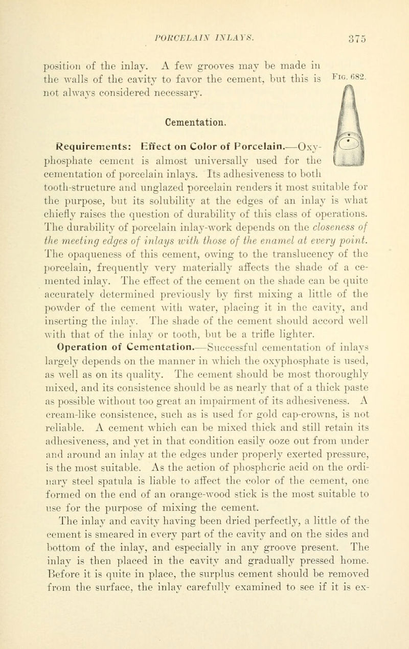 position of the inlay. A few grooves may be made in the walls of the cavity to favor the cement, but this is Fig. 682. not always considered necessary. Cementation. Requirements: Effect on Color of Porcelain.—Oxy- phosphate cement is almost universally used for the fomentation of porcelain inlays. Its adhesiveness to both tooth-structure and unglazed porcelain renders it most suitable for the purpose, but its solubility at the edges of an inlay is what chiefly raises the question of durability of this class of operations. The durability of porcelain inlay-work depends on the closeness of the meeting edges of inlays with those of the enamel at every point. The opaqueness of this cement, owing to the translucency of the porcelain, frequently very materially affects the shade of a ce- mented inlay. The effect of the cement on the shade can be quite accurately determined previously by first mixing a little of the powder of the cement with water, placing it in the cavity, ami inserting the inlay. The shade of the cement should accord well with that of the inlay or tooth, but be a trifle lighter. Operation of Cementation.—Successful cementation of inlays largely depends on the manner in which the oxyphosphate is used, as well as on its quality. The cement should be most thoroughly mixed, and its consistence should be as nearly that of a thick paste as possible without too great an impairment of its adhesiveness. A cream-like consistence, such as is used for gold cap-crowns, is not reliable. A cement which can be mixed thick and still retain its adhesiveness, and yet in that condition easily ooze out from under and around an inlay at the edges under properly exerted pressure, is the most suitable. As the action of phosphoric acid on the ordi- nary steel spatula is liable to affect the color of the cement, one formed on the end of an orange-wood stick is the most suitable to use for the purpose of mixing the cement. The inlay and cavity having been dried perfectly, a little of the cement is smeared in every part of the cavity and on the sides and bottom of the inlay, and especially in any groove present. The inlay is then placed in the cavity and gradually pressed home. Before it is quite in place, the surplus cement should be removed from the surface, the inlay carefully examined to see if it is ex-