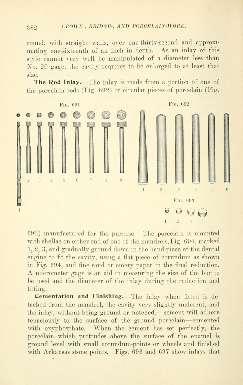 round, with straight walls, over one-thirty-second and approxi- mating one-sixteenth of an inch in depth. As an inlay of this style cannot very well be manipulated of a diameter less than No. 20 gage, the cavity requires to be enlarged to at least that size. The Rod Inlay.—The inlay is made from a portion of one of the porcelain rods (Fig. 692) or circular pieces of porcelain (Fig. Fig. 691. w %„i^ *w Fig. 692. I Fig. 693. 6 0 0 693) manufactured for the purpose. The porcelain is mounted with shellac on either end of one of the mandrels, Fig. 694, marked 1, 2, 3, and gradually ground down in the hand-piece of the dental engine to fit the cavity, using a flat piece of corundum as shown in Fig. 694, and fine sand or emery paper in the final reduction. A micrometer gage is an aid in measuring the size of the bur to be used and the diameter of the inlay during the reduction and fitting. Cementation and Finishing.—The inlay when fitted is de- tached from the mandrel, the cavity very slightly undercut, and the inlay, without being ground or notched.—cement will adhere tenaciously to the surface of the ground porcelain—cemented with oxyphosphate. When the cement has set perfectly, the porcelain which protrudes above the surface of the enamel is ground level with small corundum-points or wheels and finished with Arkansas stone points. Figs. 696 and 697 show inlays that