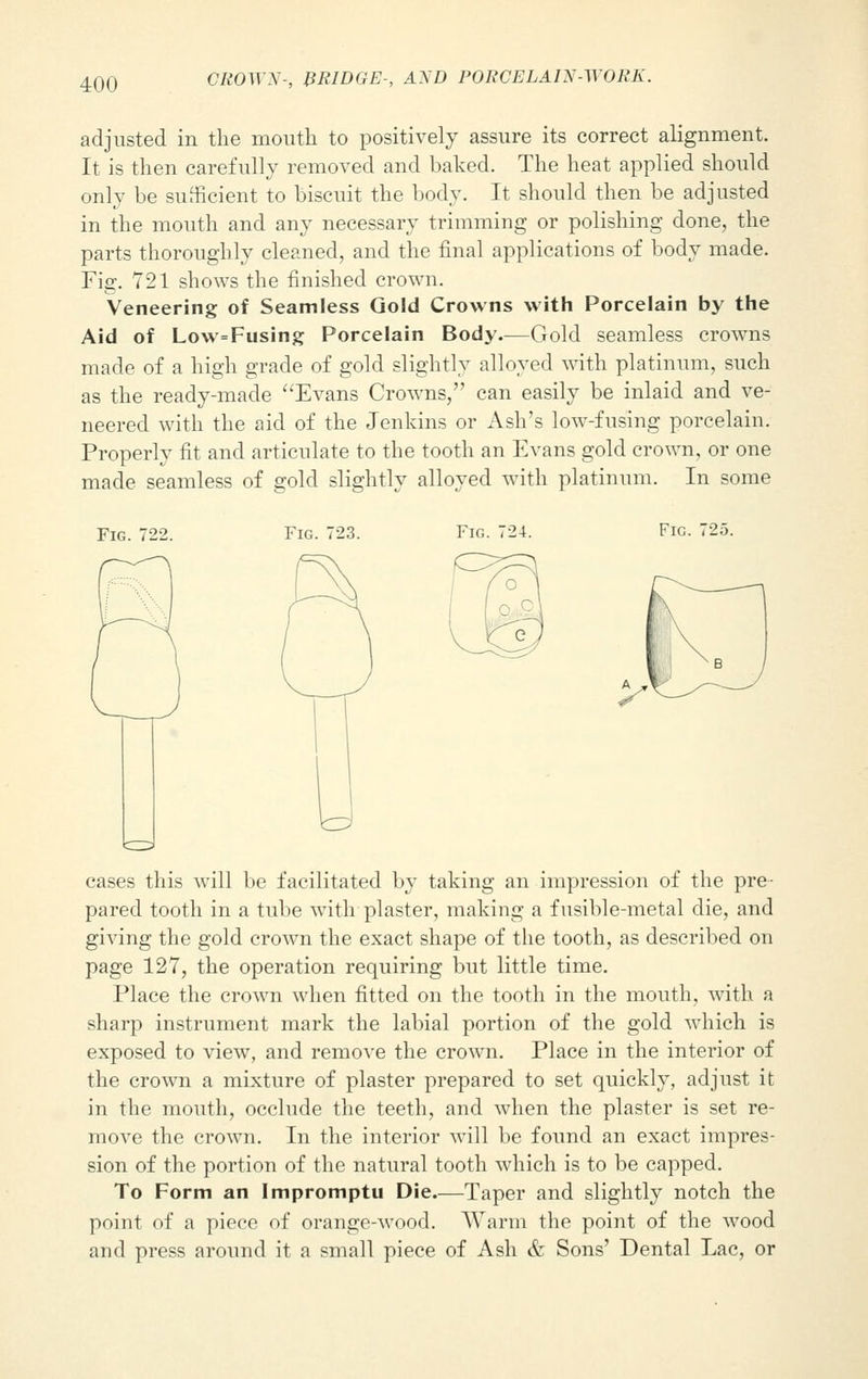 adjusted in the mouth to positively assure its correct alignment. It is then carefully removed and baked. The heat applied should only be sufficient to biscuit the body. It should then be adjusted in the mouth and any necessary trimming or polishing done, the parts thoroughly cleaned, and the final applications of body made. Fig. 721 shows the finished crown. Veneering of Seamless Gold Crowns with Porcelain by the Aid of Low=Fusing Porcelain Body.—Gold seamless crowns made of a high grade of gold slightly alloyed with platinum, such as the ready-made Evans Crowns, can easily be inlaid and ve- neered with the aid of the Jenkins or Ash's low-fusing porcelain. Properly fit and articulate to the tooth an Evans gold crown, or one made seamless of gold slightly alloyed with platinum. In some Fig. 722. Fig. 724. Fig. 725. cases this will be facilitated by taking an impression of the pre- pared tooth in a tube with plaster, making a fusible-metal die, and giving the gold crown the exact shape of the tooth, as described on page 127, the operation requiring but little time. Place the crown when fitted on the tooth in the mouth, with a sharp instrument mark the labial portion of the gold which is exposed to view, and remove the crown. Place in the interior of the crown a mixture of plaster prepared to set quickly, adjust it in the mouth, occlude the teeth, and when the plaster is set re- move the crown. In the interior will be found an exact impres- sion of the portion of the natural tooth which is to be capped. To Form an Impromptu Die.—Taper and slightly notch the point of a pieee of orange-wood. Warm the point of the wood and press around it a small piece of Ash & Sons' Dental Lac, or