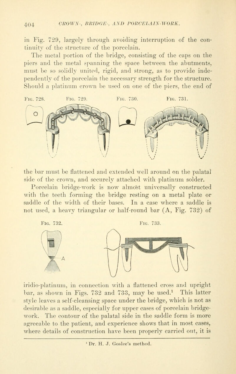 in Fig. 729, largely through avoiding interruption of the con- tinuity of the structure of the porcelain. The metal portion of the bridge, consisting of the caps on the piers and the metal spanning the space between the abutments, must be so solidly united, rigid, and strong, as to provide inde- pendently of the porcelain the necessary strength for the structure. Should a platinum crown be used on one of the piers, the end of Fig. 728. Fig. 729 Fig. 731. the bar must be flattened and extended well around on the palatal side of the crown, and securely attached with platinum solder. Porcelain bridge-work is now almofet universally constructed with the teeth forming the bridge resting on a metal plate or saddle of the width of their bases. In a case where a saddle is not used, a heavy triangular or half-round bar (A, Fig. 732) of Fig Fig. 733. iridio-platinum, in connection with a flattened cross and upright bar, as shown in Figs. 732 and 733, may be used.1 This latter style leaves a self-cleansing space under the bridge, which is not as desirable as a saddle, especially for upper cases of porcelain bridge- work. The contour of the palatal side in the saddle form is more agreeable to the patient, and experience shows that in most cases, where details of construction have been properly carried out, it is 1 Dr. H. J. Goslee's method.