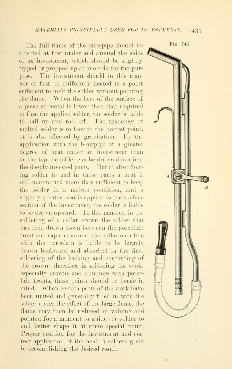 The full flame of the blowpipe should be directed at first under and around the sides of an investment, which should be slightly tipped or propped up at one side for the pur- pose. The investment should in this man- ner at tirst be uniformly heated to a point sufficient to melt the solder without pointing the dame. AVhen the heat of the surface of a piece of metal is lower than that required to fuse the applied solder, the solder is liable t<> ball up and roll off. The tendency of melted solder is to flow to the hottest point. It is also affected by gravitation. By the application with the blowpipe of a greater degree of heat under an investmenl than on the top the solder can be drawn down into the deeply invested parrs. But if after flow- ing solder to and in these parts a heat is still maintained more than sufficient to keep the solder in a molten condition, and a slightly greater heat i- applied to the surface section of the investment, the -older is liable to he drawn upward. In this manner, in the soldering of a collar crown the solder thai has been drawn down between the porcelain front and cap and around the collar on a line with the porcelain is liable to be largely drawn backward and absorbed in the final soldering of the backing and contouring of the crown; therefore in soldering the work, especially crowns and dummies with porce- lain fronts, these points should be borne in mind. AVhen certain parts of the work have been united and generally filled in with the solder under the effect of the large flame, the flame may then be reduced in volume and pointed for a moment to guide the solder to and better shape it at some special point. Proper position for the investment and cor- rect application of the heat in soldering aid in accomplishing the desired result. Fig. 749.
