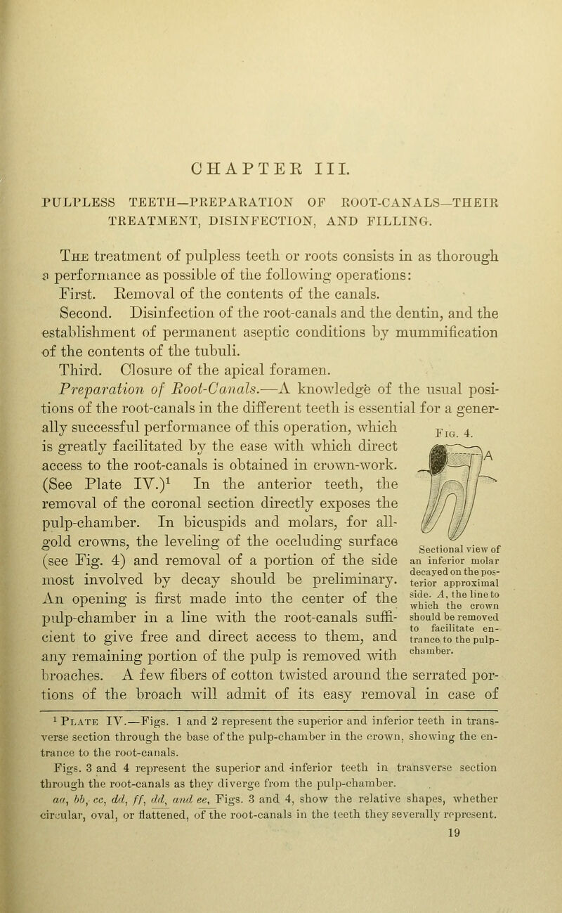 Fig. 4. PULPLESS TEETH—PKEPAKATION OF ROOT-CANALS—THEIR TREATMENT, DISINFECTION, AND FILLING. The treatment of piilpless teeth or roots consists in as thorough s performance as possible of the following operations: First. Removal of the contents of the canals. Second. Disinfection of the root-canals and the dentin, and the establishment of permanent aseptic conditions by mummification of the contents of the tubuli. Third. Closure of the apical foramen. Pre'paration of Root-Canals.—A knowledge of the usual posi- tions of the root-canals in the different teeth is essential for a gener- ally successful performance of this operation, which is greatly facilitated by the ease with which direct access to the root-canals is obtained in cro^vn-work. (See Plate IV.)^ In the anterior teeth, the removal of the coronal section directly exposes the pulp-chamber. In bicuspids and molars, for all- gold crowns, the leveling of the occluding surface (see Fig. 4) and removal of a portion of the side most involved by decay should be preliminary. An opening is first made into the center of the pulp-chamber in a line with the root-canals suffi- cient to give free and direct access to them, and any remaining portion of the pulp is removed mth broaches. A few fibers of cotton twisted around the serrated por- tions of the broach will admit of its easy removal in case of 1 Plate IV.—Figs. 1 and 2 represent the superior and inferior teeth in trans- verse section through the base of the pulp-chamber in the crown, showing the en- trance to the root-canals. Figs. 3 and 4 represent the superior and -inferior teeth in transverse section through the root-canals as they diverge from the pulp-chamber. aa, hb, cc, dd, ff, dd, and ee, Figs. 3 and 4, show the relative shapes, whether circular, oval, or flattened, of the root-canals in the teeth they severally represent. 19 Sectional view of an inferior molar decayed on the pos- terior approximal side. A, the line to which the crown should be removed to facilitate en- trance to the pulp- chamber.