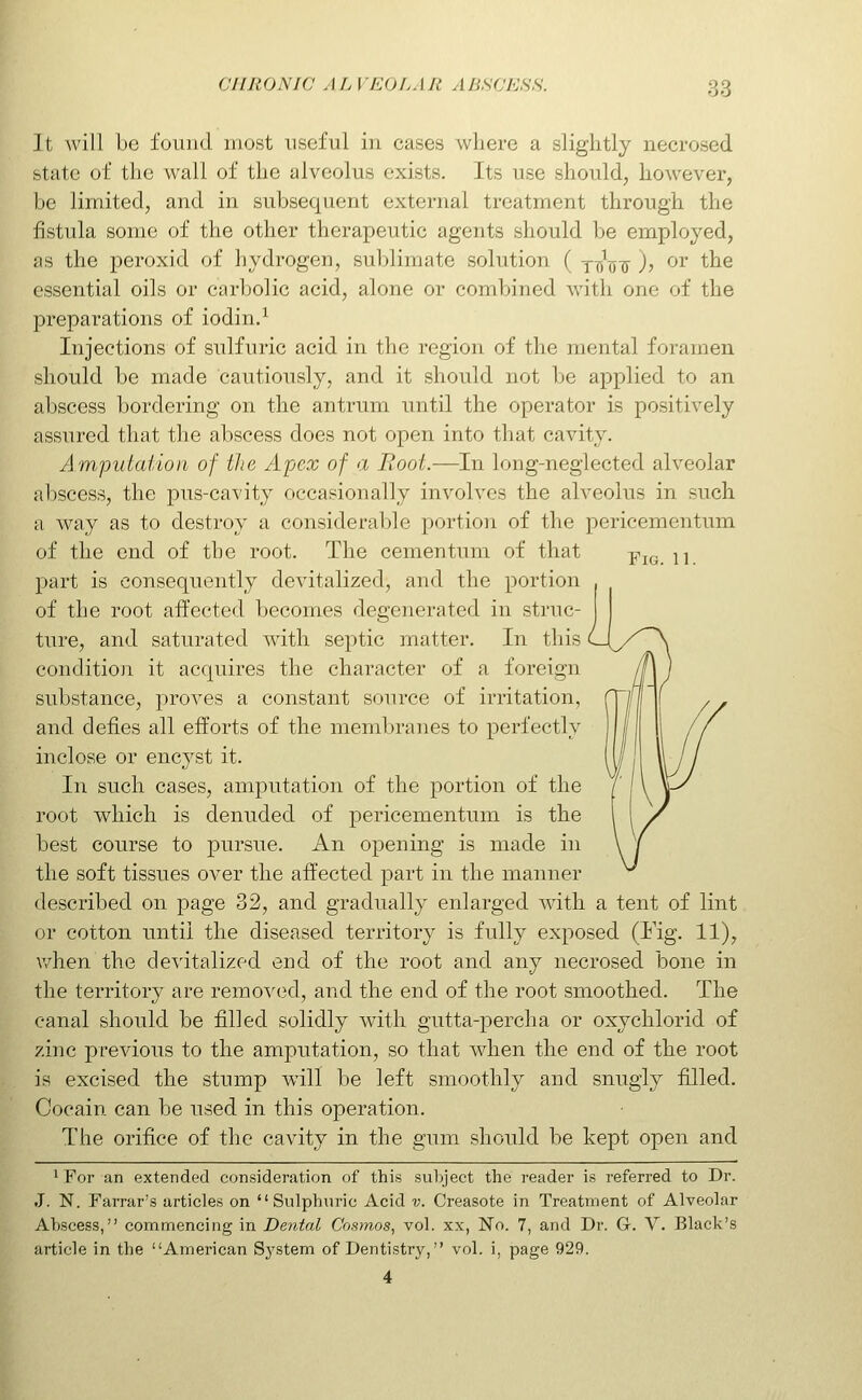 It Avill be found most useful in cases where a slightly necrosed state of the wall of the alveolus exists. Its use should, however, be limited, and in subsequent external treatment through the fistula some of the other therapeutic agents should be employed, as the peroxid of hydrogen, sublimate solution ( yt/utt )j ^^ the essential oils or carbolic acid, alone or combined with one of the preparations of iodin.^ Injections of sulfuric acid in the region of the mental foramen should be made cautiously, and it should not be applied to an abscess bordering on the antrum until the operator is positively assured that the abscess does not open into that cavity. Amputation of tlie Apex of a Root.—In long-neglected alveolar abscess, the pus-cavity occasionally involves the alveolus in such a way as to destroy a considerable portion of the pericementum of the end of the root. The cementum of that yiq. 11. part is consequently devitalized, and the portion of the root affected becomes degenerated in struc- ture, and saturated with septic matter. In this condition it acquires the character of a foreign substance, proves a constant source of irritation, and defies all efforts of the membranes to perfectly inclose or encj'^st it. In such cases, amputation of the portion of the root which is denuded of pericementum is the best course to pursue. An opening is made in the soft tissues over the affected part in the manner described on page 32, and gradually enlarged with a tent of lint or cotton until the diseased territory is fully exposed (Fig. 11), when the devitalized end of the root and any necrosed bone in the territory are removed, and the end of the root smoothed. The canal should be filled solidly with gutta-percha or oxychlorid of zinc previous to the amputation, so that when the end of the root is excised the stump will be left smoothly and snugly filled. Cocain can be used in this operation. The orifice of the cavity in the gum should be kept open and 1 For an extended consideration of this suly'ect the reader is referred to Dr. J. N. Farrar's articles on Sulphuric Acid v. Creasote in Treatment of Alveolar Abscess, commencing in Dental Cosmos^ vol. xx, No. 7, and Dr. G. V. Black's article in the American Sj^stem of Dentistry, vol. i, page 929. 4