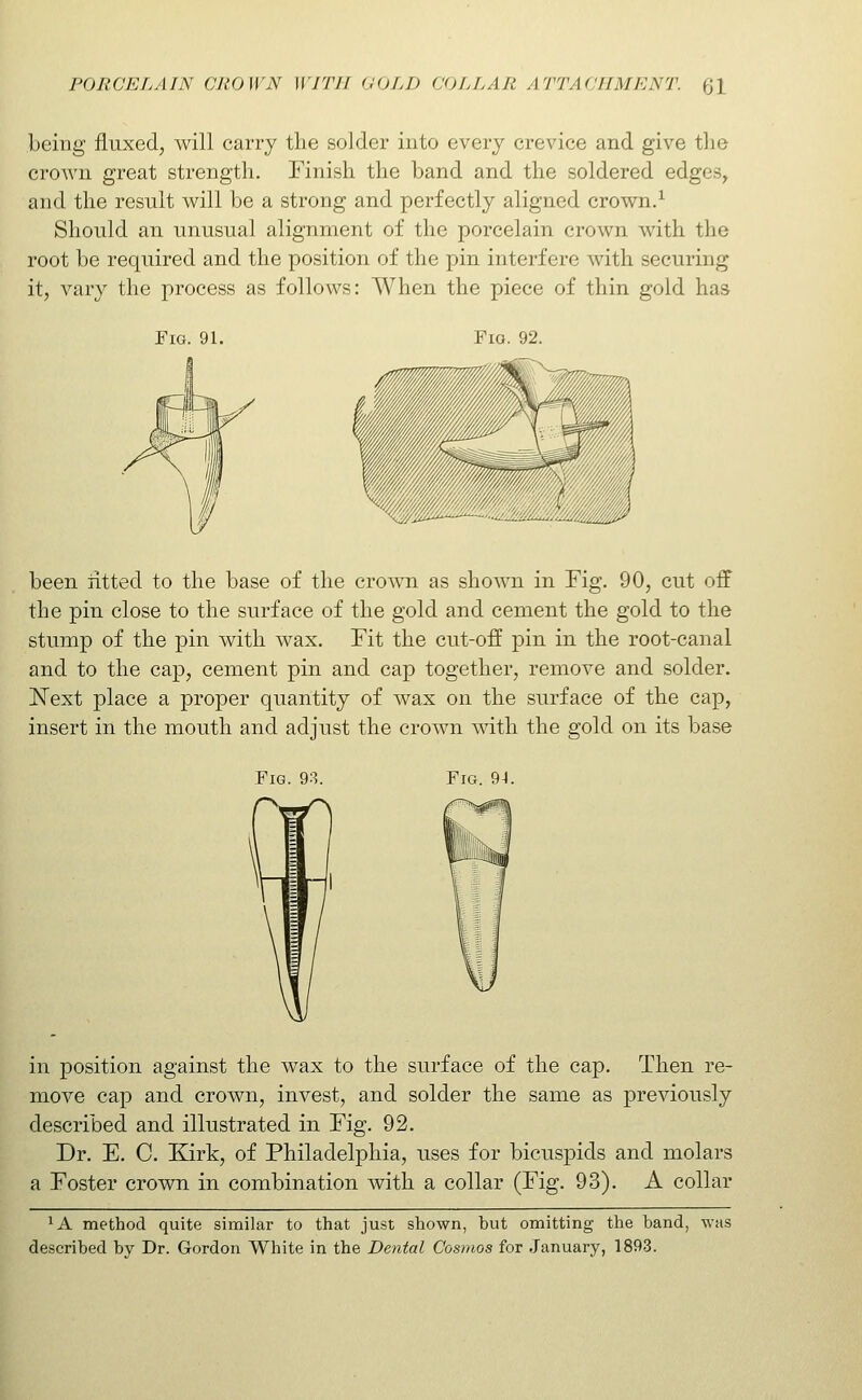 being fluxed, will carry the solder into every crevice and give tlie crown great strength. Finish the band and the soldered edges, and the result will be a strong and perfectly aligned crown.^ Should an unusual alignment of the porcelain crown with the root be required and the position of the pin interfere with securing it, vary the process as follows: When the piece of thin gold has Fig. 91. Fig. 92. been fitted to the base of the crown as shown in Fig. 90, cut off the pin close to the surface of the gold and cement the gold to the stump of the pin with wax. Fit the cut-off pin in the root-canal and to the cap, cement pin and cap together, remove and solder, l^ext place a proper quantity of wax on the surface of the cap, insert in the mouth and adjust the crown mth the gold on its base Fig. 98. Fig. 94. in position against the wax to the surface of the cap. Then re- move cap and crown, invest, and solder the same as previously described and illustrated in Fig. 92. Dr. E. C. Kirk, of Philadelphia, uses for bicuspids and molars a Foster crown in combination with a collar (Fig. 93). A collar lA method quite similar to that just shown, but omitting the band, was described by Dr. Gordon White in the Dental Cosmos for January, 1893.