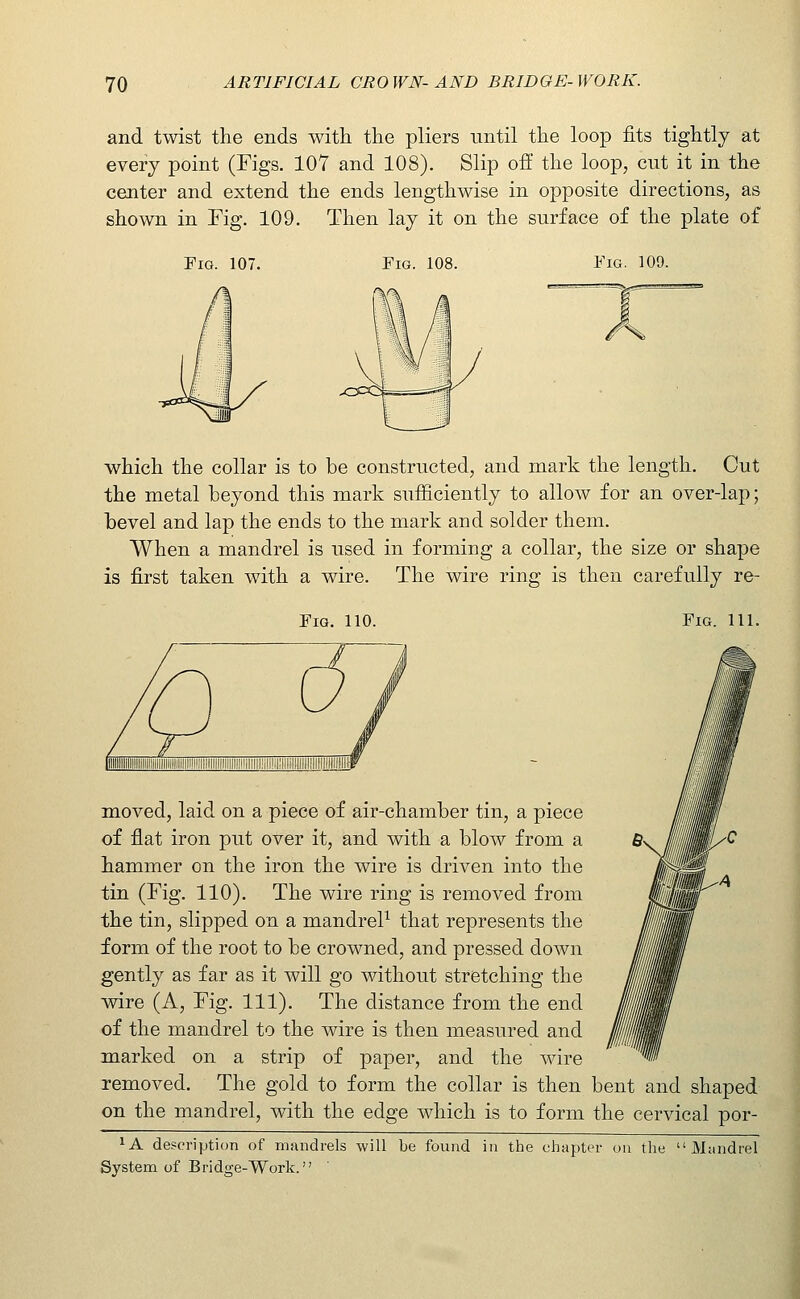 and twist the ends witk the pliers until the loop fits tightly at every point (Figs. 107 and 108). Slip ofi the loop, cut it in the center and extend the ends lengthwise in opposite directions, as shown in Fig. 109. Then lay it on the surface of the plate of Fig. 107. Fig. 108. Fig. 109. which the collar is to be constructed, and mark the length. Cut the metal beyond this mark sufficiently to allow for an over-lap; bevel and lap the ends to the mark and solder them. When a mandrel is used in forming a collar, the size or shape is first taken with a wire. The wire ring is then carefully re- FiG. 110. Fig. 111. illllllllllllllllliilllll!lllllil!llllllllllllllllll|lilllll!ill!l|!|llilllllllllllllllW moved, laid on a piece of air-chamber tin, a piece of flat iron put over it, and with a blow from a hammer on the iron the wire is driven into the tin (Fig. 110). The wire ring is removed from the tin, slipped on a mandreP that represents the form of the root to be crowned, and pressed down gently as far as it will go without stretching the wire (A, Fig. 111). The distance from the end of the mandrel to the wire is then measured and marked on a strip of paper, and the wire removed. The gold to form the collar is then bent and shaped on the mandrel, with the edge which is to form the cervical por- ^A description of mandrels will be found in the chapter on the Mandrel System of Bridge-Work.