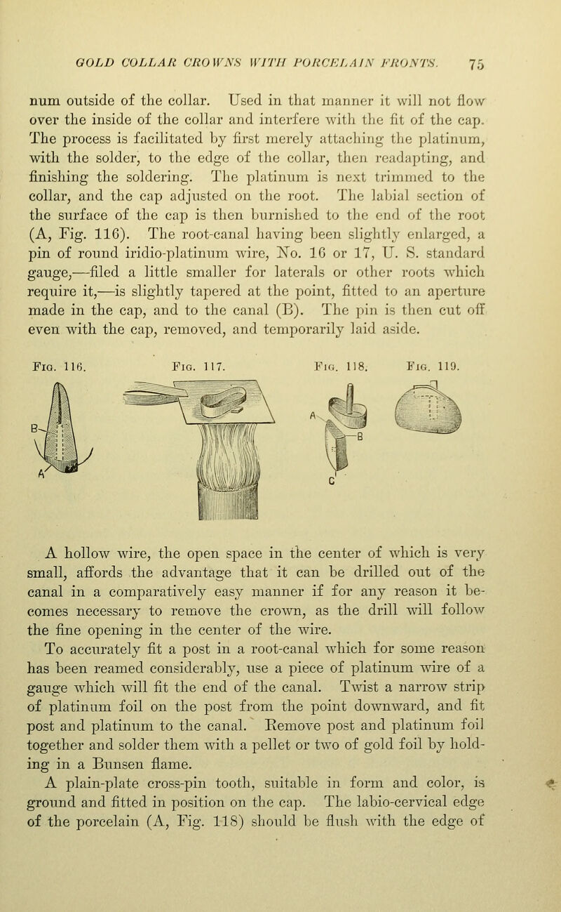num outside of the collar. Used in that manner it will not flow over the inside of the collar and interfere with the fit of the cap. The process is facilitated by first merely attaching the platinum, with the solder, to the edge of the collar, then readapting, and finishing the soldering. The platinum is next trimmed to the collar, and the cap adjusted on the root. The labial section of the surface of the cap is then burnished to the end of the root (A, Fig. 116). The root-canal having been slightly enlarged, a pin of round iridio-platinum wire, ]S[o. 16 or 17, U. S. standard gauge,—filed a little smaller for laterals or other roots which require it,—is slightly tapered at the point, fitted to an aperture made in the cap, and to the canal (B). The pin is then cut off even with the cap, removed, and temporarily laid aside. Fig. 116. Fig. 117. Fig. 118. Fig. 119. A hollow wire, the open space in the center of which is very small, affords the advantage that it can be drilled out of the canal in a comparatively easy manner if for any reason it be- comes necessary to remove the crown, as the drill will follow the fine opening in the center of the wire. To accurately fit a post in a root-canal which for some reason has been reamed considerably, use a piece of platinum wire of a gauge which will fit the end of the canal. Twist a narrow strip of platinum foil on the post from the point downward, and fit post and platinum to the canal. Remove post and platinum foil together and solder them with a pellet or two of gold foil by hold- ing in a Bunsen flame. A plain-plate cross-pin tooth, suitable in form and color, is ground and fitted in position on the cap. The labio-cervical edge of the porcelain (A, Fig. 118) should be flush with the edge of