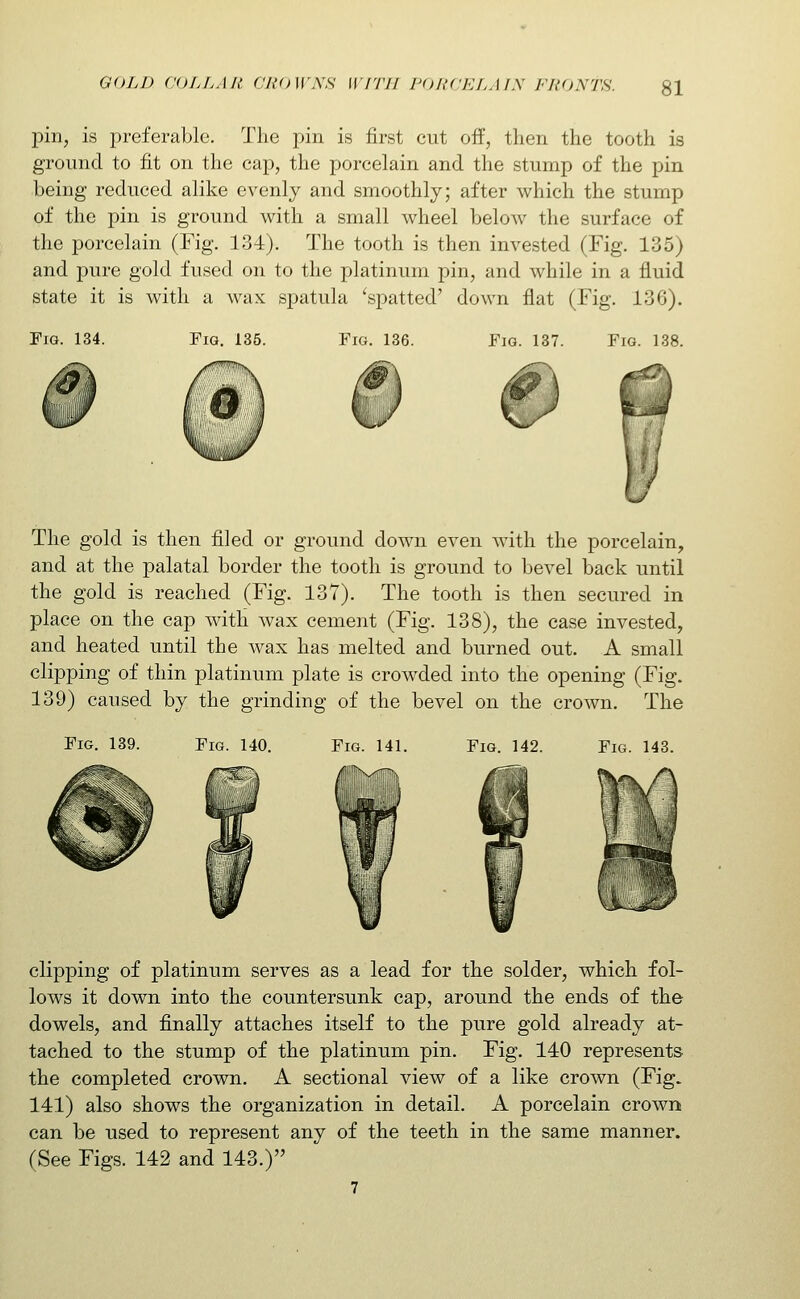 pin, is preferable. The pin is first cut off, then the tooth is ground to fit on the cap, the porcelain and the stump of the pin being reduced alike evenly and smoothly; after which the stump of the pin is ground with a small wheel below the surface of the porcelain (Fig. 134). The tooth is then invested (Fig. 135) and pure gold fused on to the platinum jDin, and while in a fluid state it is with a wax spatula 'spatted' down flat (Fig. 136). Fig. 134. Fig. 135. Fig. 136. Fig. 137. Fig. 138. The gold is then filed or ground down even with the porcelain, and at the palatal border the tooth is ground to bevel back until the gold is reached (Fig. 137). The tooth is then secured in place on the cap with wax cement (Fig. 138), the case invested, and heated until the wax has melted and burned out. A small clipping of thin platinum plate is crowded into the opening (Fig. 139) caused by the grinding of the bevel on the crown. The Fig. 139. Fig. 140. Fig. 141. Fig. 142. Fig. 143. clipping of platinum serves as a lead for the solder, which fol- lows it down into the countersunk cap, around the ends of the dowels, and finally attaches itself to the pure gold already at- tached to the stump of the platinum pin. Fig. 140 represents the completed crown. A sectional view of a like crown (Fig. 141) also shows the organization in detail. A porcelain crown can be used to represent any of the teeth in the same manner. (See Figs. 142 and 143.) 7