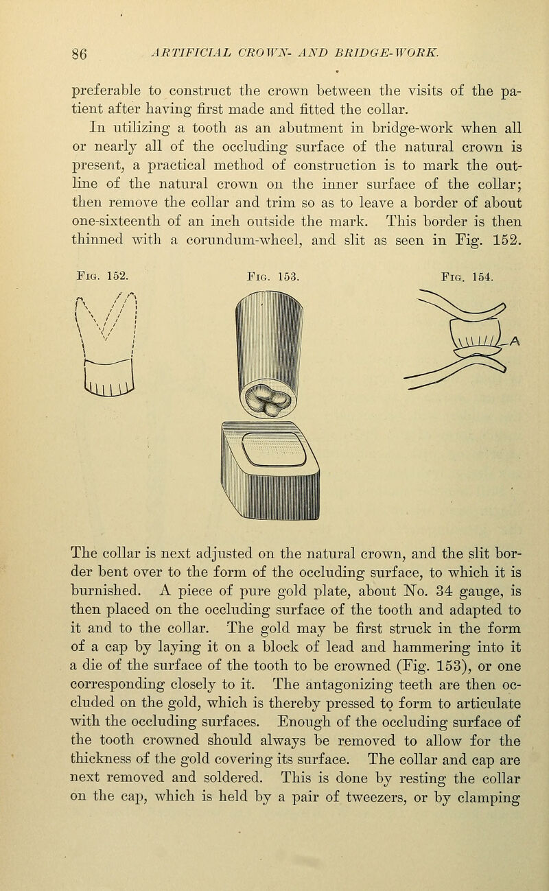 preferable to construct the crown between the visits of the pa- tient after having first made and fitted the collar. In utilizing a tooth as an abutment in bridge-work when all or nearly all of the occluding surface of the natural crown is present, a practical method of construction is to mark the out- line of the natural crown on the inner surface of the collar; then remove the collar and trim so as to leave a border of about one-sixteenth of an inch outside the mark. This border is then thinned with a corundum-wheel, and slit as seen in Fig. 152. Fig. 152. Fig. 153. Fig. 154. The collar is next adjusted on the natural crown, and the slit bor- der bent over to the form of the occluding surface, to which it is burnished. A piece of pure gold plate, about ISTo. 34 gauge, is then placed on the occluding surface of the tooth and adapted to it and to the collar. The gold may be first struck in the form of a cap by laying it on a block of lead and hammering into it a die of the surface of the tooth to be crowned (Fig. 153), or one corresponding closely to it. The antagonizing teeth are then oc- cluded on the gold, which is thereby pressed to form to articulate with the occluding surfaces. Enough of the occluding surface of the tooth crowned should always be removed to allow for the thickness of the gold covering its surface. The collar and cap are next removed and soldered. This is done by resting the collar on the cap, which is held by a pair of tweezers, or by clamping