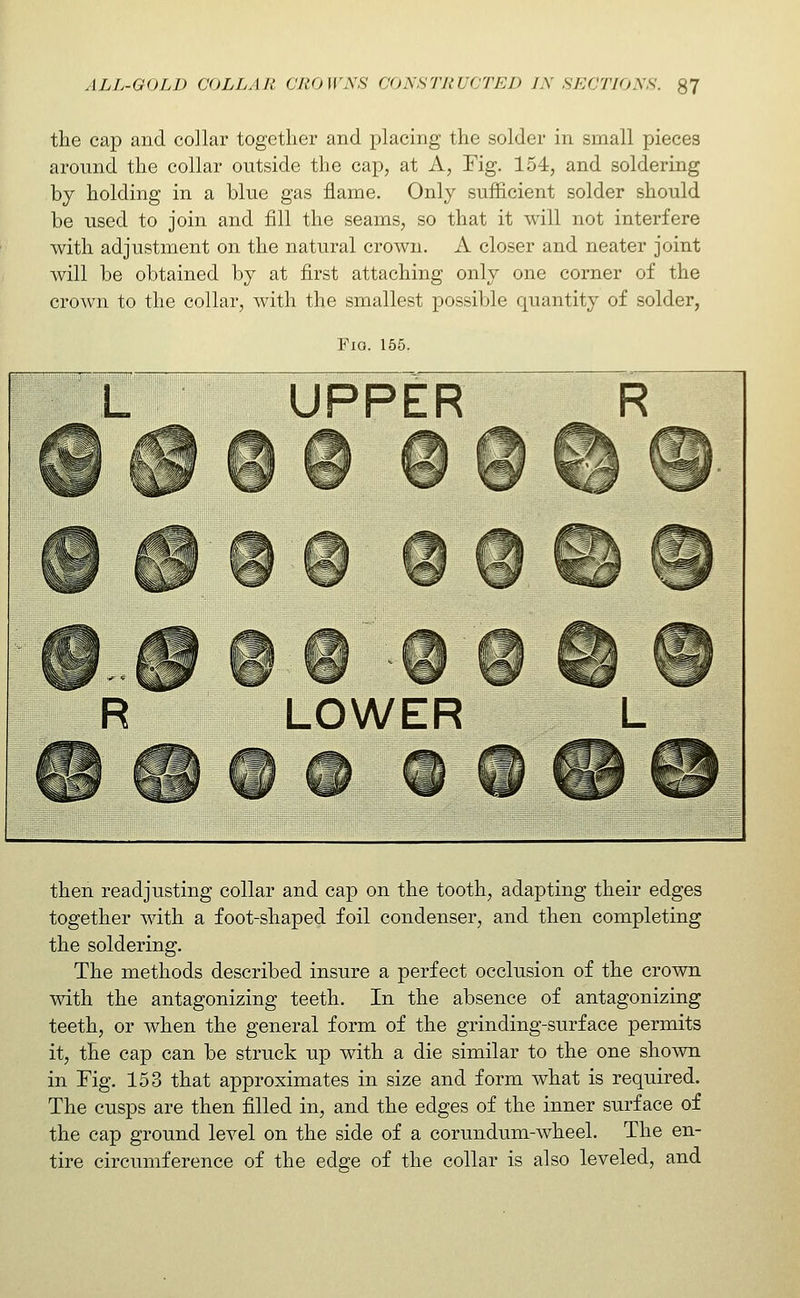 the cap and collar together and placing the solder in small pieces around the collar outside the cap, at A, Fig. 154, and soldering by holding in a blue gas flame. Only sufficient solder should be used to join and fill the seams, so that it will not interfere with adjustment on the natural crown. A closer and neater joint will be obtained by at first attaching only one corner of the crown to the collar, with the smallest possible quantity of solder, Fio. 155. UPPER LOWER then readjusting collar and cap on the tooth, adapting their edges together with a foot-shaped foil condenser, and then completing the soldering. The methods described insure a perfect occlusion of the crown with the antagonizing teeth. In the absence of antagonizing teeth, or when the general form of the grinding-surface permits it, the cap can be struck up with a die similar to the one shown in Fig. 153 that approximates in size and form what is required. The cusps are then filled in, and the edges of the inner surface of the cap ground level on the side of a corundum-wheel. The en- tire circumference of the edge of the collar is also leveled, and