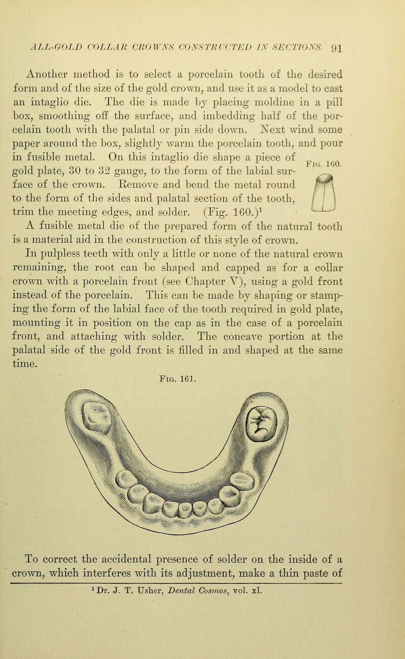 160. Another method is to select a porcelain tooth of the desired form and of the size of the gold crown, and use it as a model to cast an intaglio die. The die is made by placing moldine in a pill box, smoothing off the surface, and imbedding half of the por- celain tooth with the palatal or pin side down. Kext wind some paper around the box, slightly warm the porcelain tooth, and pour in fusible metal. On this intaglio die shape a piece of gold plate, 30 to 32 gauge, to the form of the labial sur- face of the crown. Kemove and bend the metal round to the form of the sides and palatal section of the tooth, trim the meeting edges, and solder. (Fig. 160.)^ A fusible metal die of the prepared form of the natural tooth is a material aid in the construction of this style of crown. In pulpless teeth with only a little or none of the natural crown remaining, the root can be shaped and capped as for a collar crown with a porcelain front (see Chapter V), using a gold front instead of the porcelain. This can be made by shaping or stamp- ing the form of the labial face of the tooth required in gold plate, mounting it in position on the cap as in the case of a porcelain front, and attaching with solder. The concave portion at the palatal side of the gold front is filled in and shaped at the same time. Fig. 161. To correct the accidental presence of solder on the inside of a crown, which interferes with its adjustment, make a thin paste of 1 Dr. J. T. Usher, Dental Cosmos, vol. xl.
