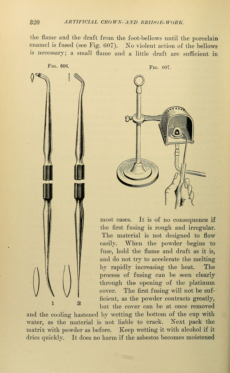 the ilame and the draft from the foot-bellows until the porcelain enamel is fused (see Fig. 607). No violent action of the bellows is necessary; a small flame and a little draft are sufficient in Fig. 606. Fig. 607. most cases. It is of no consequence if the first fusing is rough and irregular. The material is not designed to flow easily. When the powder begins to fuse, hold the flame and draft as it is, and do not try to accelerate the melting by rapidly increasing the heat. The process of fusing can be seen clearly through the opening of the platinum cover. The first fusing will not be suf-' ficient, as the powder contracts greatly, but the cover can be at once removed and the cooling hastened by wetting the bottom of the cup with water, as the material is not liable to crack. Next pack the matrix with powder as before. Keep wetting it with alcohol if it dries quickly. It does no harm if the asbestos becomes moistened