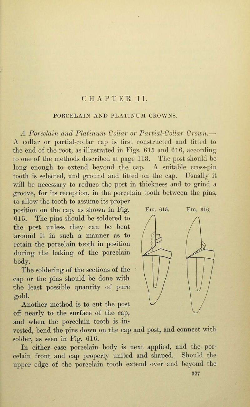 CHAPTEE 11. PORCELAIN AND PLATINUM CKOWNS. Fig. 615. Fig. 616. A Porcelain and Platinum Collar or Partial-Collar Crown.— A collar or partial-collar cap is first constructed and fitted to the end of the root, as illustrated in Figs. 615 and 616, according to one of the methods described at page 113. The post should be long enough to extend beyond the cap. A suitable cross-pin tooth is selected, and ground and fitted on the cap. Usually it will be necessary to reduce the post in thickness and to grind a groove, for its reception, in the porcelain tooth between the pins, to allow the tooth to assume its proper position on the cap, as shown in Fig. 615. The pins should be soldered to the post unless they can be bent iaround it in such a manner as to retain the porcelain tooth in position during the baking of the porcelain body. The soldering of the sections of the cap or the pins should be done with ithe least possible quantity of pure gold. Another method is to cut the post off nearly to the surface of the cap, and when the porcelain tooth is in- vested, bend the pins down on the cap and post, and connect with solder, as seen in Fig. 616. In either case porcelain body is next applied, and the por- celain front and cap properly united and shaped. Should the upper edge of the porcelain tooth extend over and beyond the