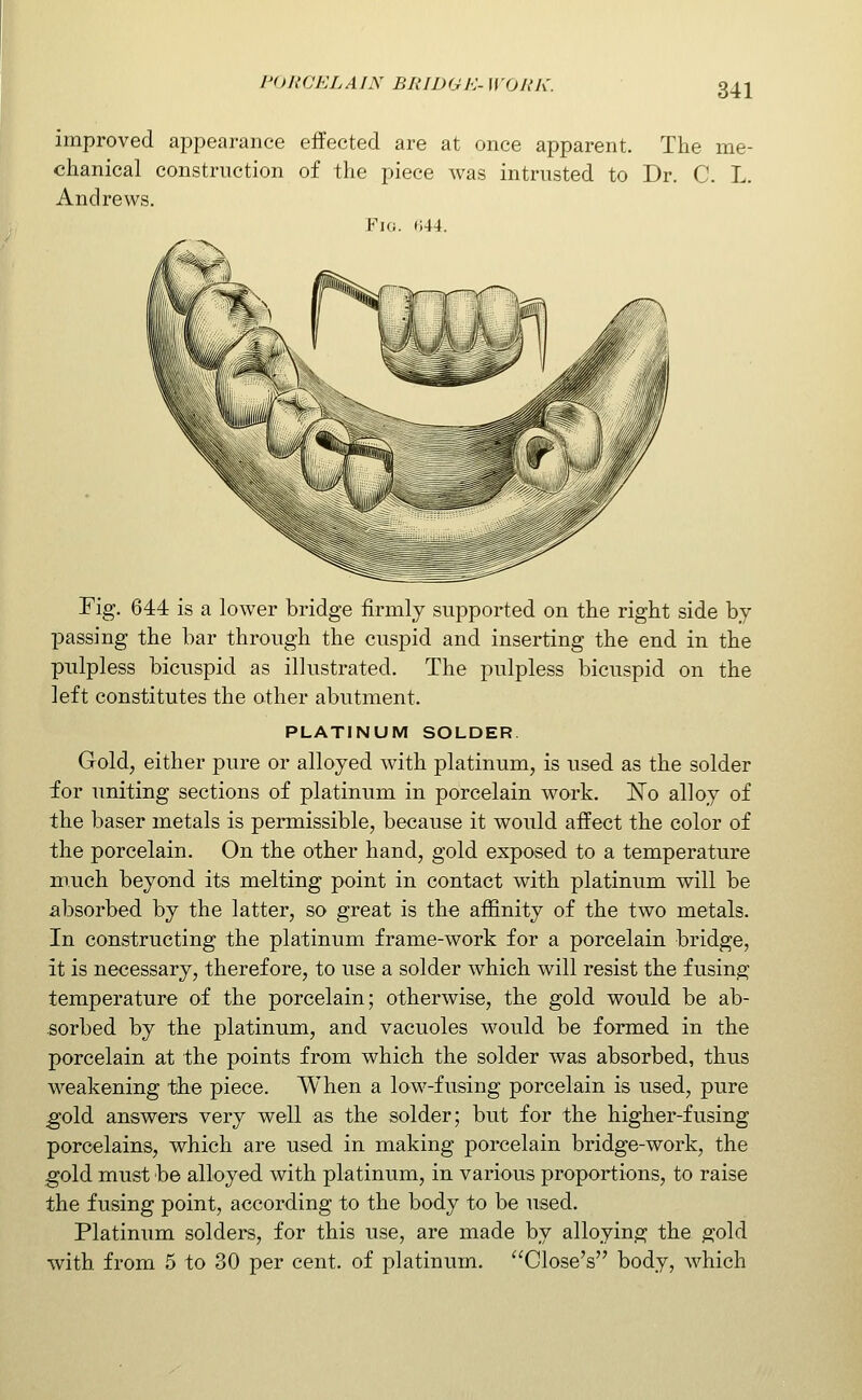 improved appearance effected are at once apparent. The me- chanical construction of the piece was intrusted to Dr. C. L. Andrews. Fig. 044. Fig. 644 is a lower bridge firmly supported on the right side by passing the bar through the cuspid and inserting the end in the pulpless bicuspid as illustrated. The pulpless bicuspid on the left constitutes the other abutment. PLATINUM SOLDER Gold, either pure or alloyed with platinum, is used as the solder for uniting sections of platinum in porcelain work. ISTo alloy of the baser metals is permissible, because it would affect the color of the porcelain. On the other hand, gold exposed to a temperature much beyond its melting point in contact with platinum will be iibsorbed by the latter, so great is the affinity of the two metals. In constructing the platinum frame-work for a porcelain bridge, it is necessary, therefore, to use a solder which will resist the fusing temperature of the porcelain; otherwise, the gold would be ab- sorbed by the platinum, and vacuoles would be formed in the porcelain at the points from which the solder was absorbed, thus weakening the piece. When a low-fusing porcelain is used, pure gold answers very well as the solder; but for the higher-fusing porcelains, which are used in making porcelain bridge-work, the gold must be alloyed with platinum, in various proportions, to raise the fusing point, according to the body to be used. Platinum solders, for this use, are made by alloying the gold with from 5 to 30 per cent, of platinum. Close's body, which