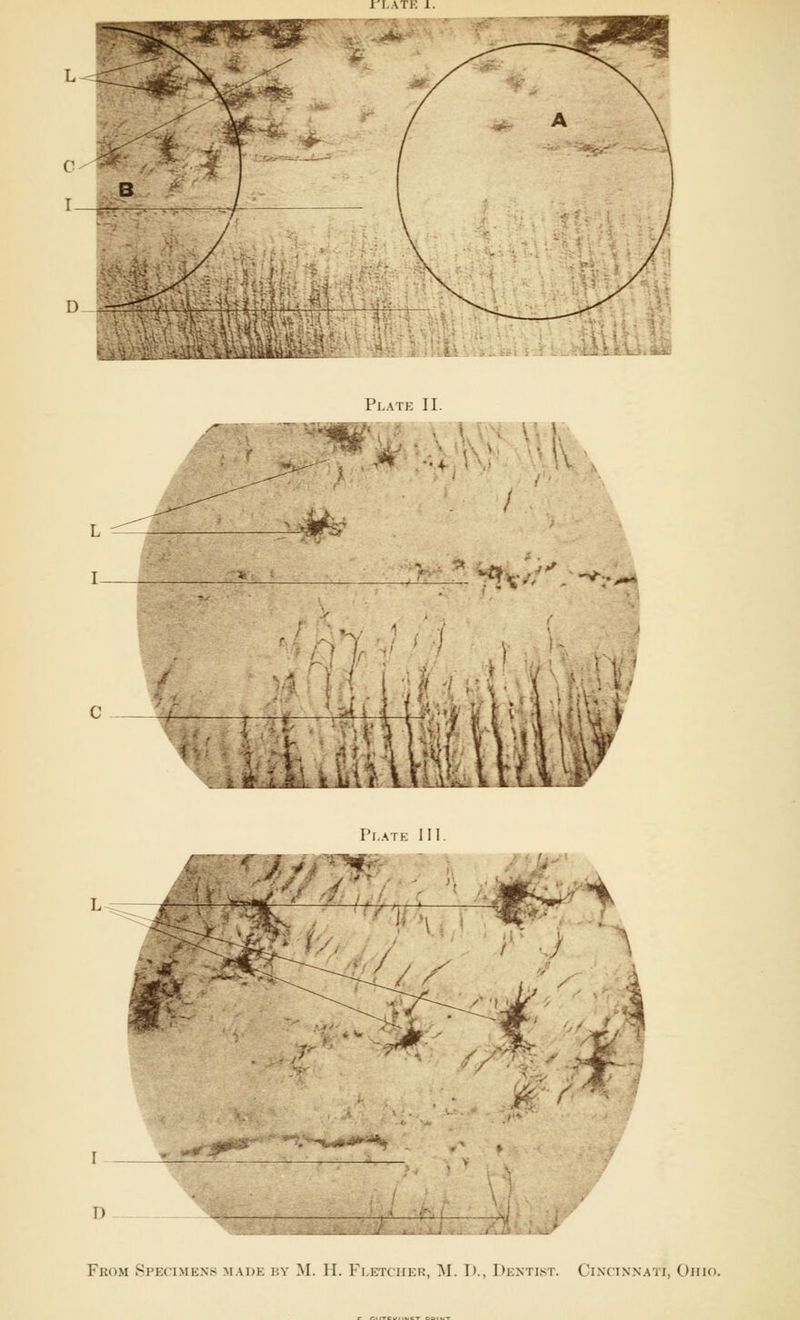 Plate II. M , J* ■ \ ! Plate III. w% - t