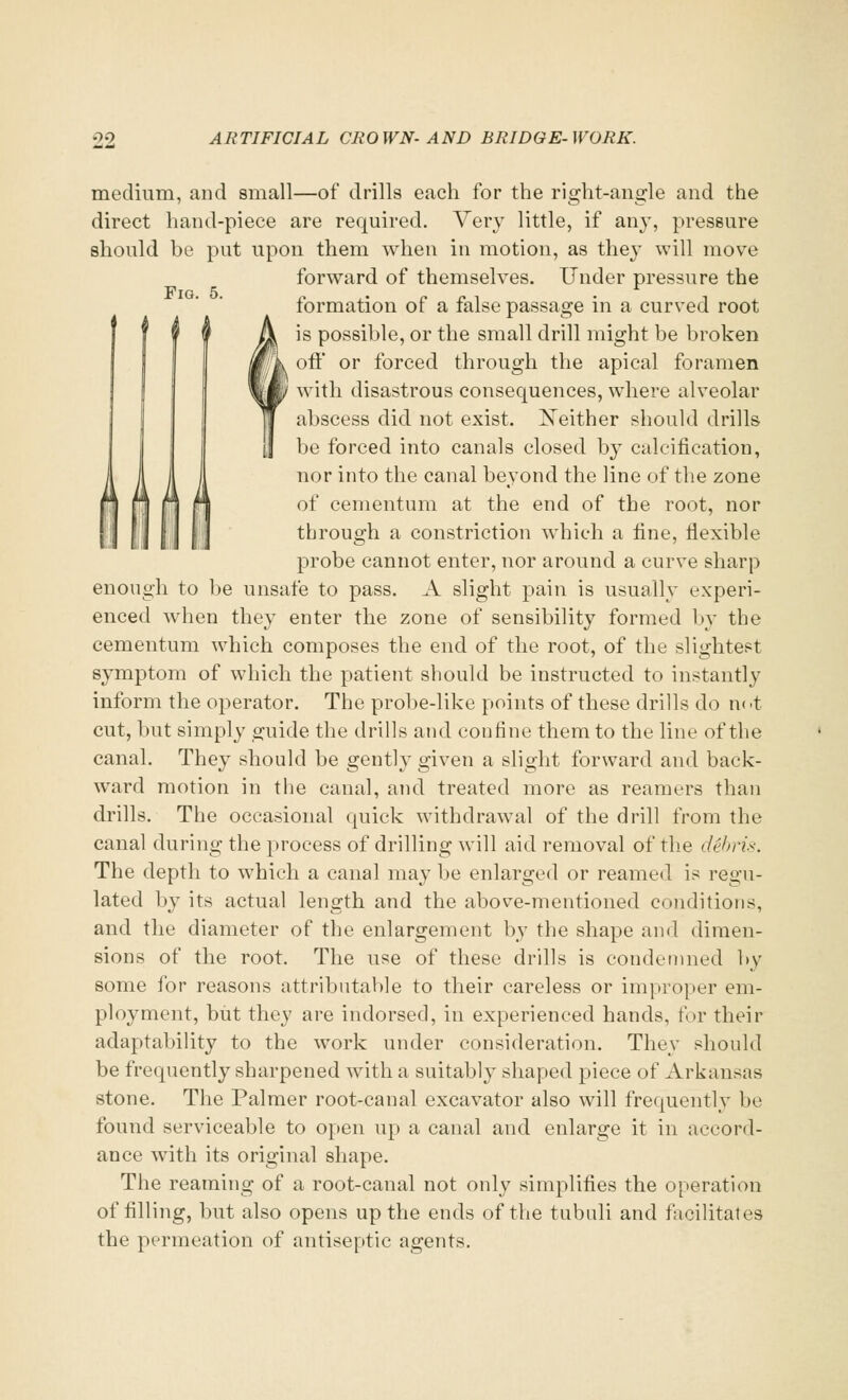 Fig. 5. medium, and small—of drills each for the right-angle and the direct hand-piece are required. Very little, if an}', pressure should be put upon them when in motion, as they will move forward of themselves. Under pressure the formation of a false passage in a curved root is possible, or the small drill might be broken off or forced through the apical foramen with disastrous consequences, where alveolar abscess did not exist. Neither should drills be forced into canals closed by calcification, nor into the canal beyond the line of the zone of cementum at the end of the root, nor through a constriction which a fine, flexible probe cannot enter, nor around a curve sharp enough to be unsafe to pass. A slight pain is usually experi- enced when they enter the zone of sensibility formed by the cementum which composes the end of the root, of the slightest symptom of which the patient should be instructed to instantly inform the operator. The probe-like points of these drills do n< >t cut, but simply guide the drills and confine them to the line of the canal. They should be gently given a slight forward and back- ward motion in the canal, and treated more as reamers than drills. The occasional quick withdrawal of the drill from the canal during the process of drilling will aid removal of the debris. The depth to which a canal may be enlarged or reamed is regu- lated by its actual length and the above-mentioned conditions, and the diameter of the enlargement by the shape and dimen- sions of the root. The use of these drills is condemned by some for reasons attributable to their careless or improper em- ployment, but they are indorsed, in experienced hands, for their adaptability to the work under consideration. They should be frequently sharpened with a suitably shaped piece of Arkansas stone. The Palmer root-canal excavator also will frequently be found serviceable to open up a canal and enlarge it in accord- ance with its original shape. The reaming of a root-canal not only simplifies the operation of filling, but also opens up the ends of the tubnli and facilitates the permeation of antiseptic agents.