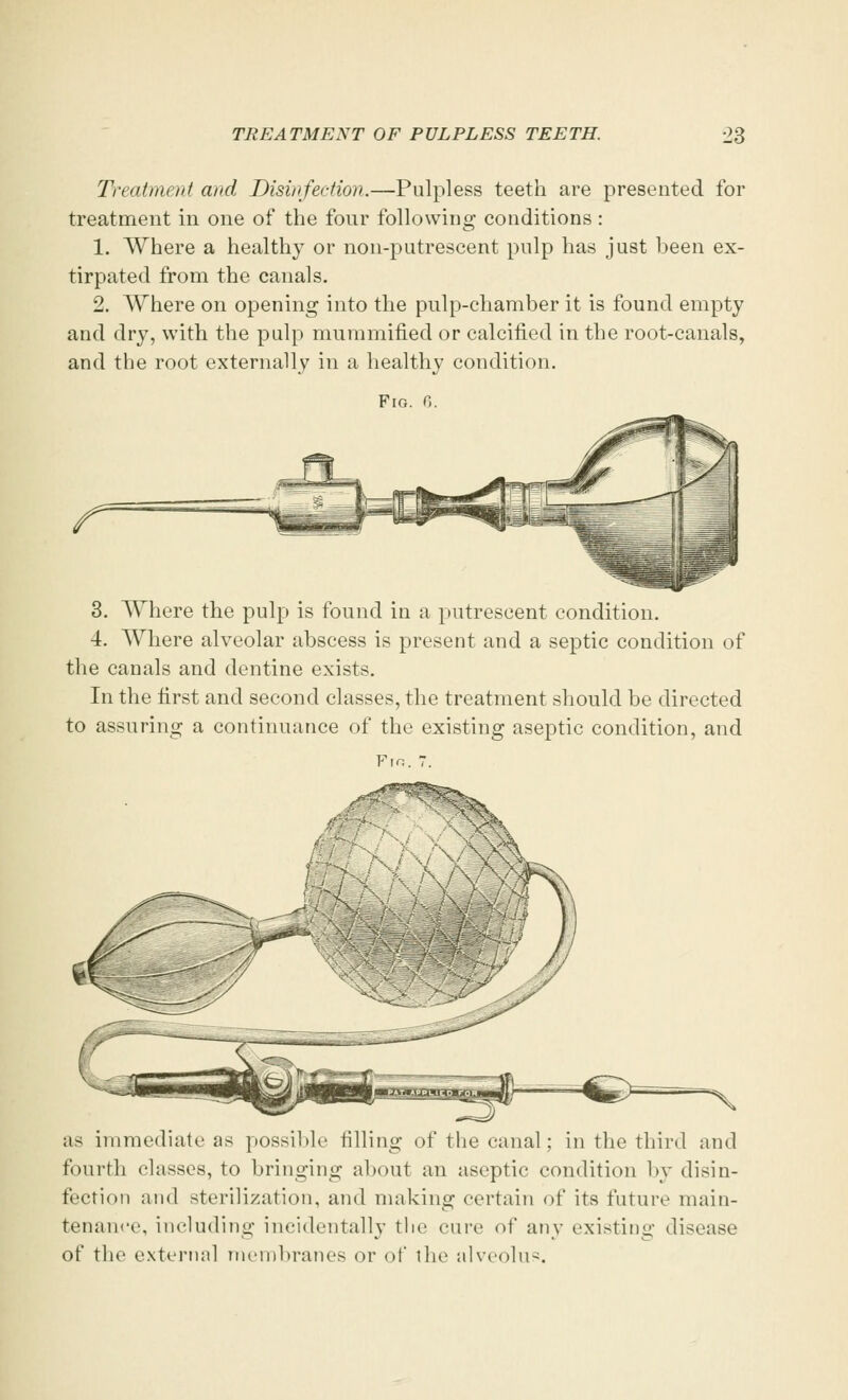 Treatment and Disinfection.—Pulpless teeth are presented for treatment in one of the four following conditions: 1. Where a healthy or non-putrescent pulp has just been ex- tirpated from the canals. 2. Where on opening into the pulp-chamber it is found empty and dry, with the pulp mummified or calcified in the root-canals, and the root externally in a healthy condition. Fig. 6. 3. Where the pulp is found in a putrescent condition. 4. Where alveolar abscess is present and a septic condition of the canals and dentine exists. In the first and second classes, the treatment should be directed to assuring a continuance of the existing aseptic condition, and Fin. 7. as immediate as possible filling of the canal; in the third and fourth classes, to bringing about an aseptic condition by disin- fection and sterilization, and making certain of its future main- tenance, including incidentally the cure of any existing disease of the external membranes or of the alveolus.