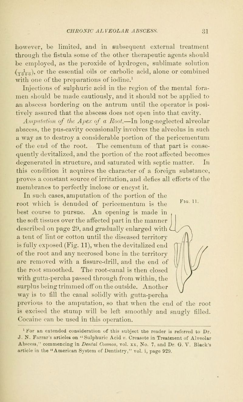however, be limited, and in subsequent external treatment through the fistula some of the other therapeutic agents should be employed, as the peroxide of hydrogen, sublimate solution (toVo)' or t^e essential oils or carbolic acid, alone or combined with one of the preparations of iodine.1 Injections of sulphuric acid in the region of the mental fora- men should be made cautiously, and it should not be applied to an abscess bordering on the antrum until the operator is posi- tively assured that the abscess does not open into that cavity. Amputation of the Apex of a Root.—In long-neglected alveolar abscess, the pus-cavity occasionally involves the alveolus in such a way as to destroy a considerable portion of the pericementum of the end of the root. The cementum of that part is conse- quently devitalized, and the portion of the root affected becomes degenerated in structure, and saturated with septic matter. In this condition it acquires the character of a foreign substance, proves a constant source of irritation, and defies all efforts of the membranes to perfectly inclose or encyst it. In such cases, amputation of the portion of the root which is denuded of pericementum is the best course to pursue. An opening is made in the soft tissues over the affected part in the manner described on page 29, and gradually enlarged with a tent of lint or cotton until the diseased territory is fully exposed (Fig. 11), when the devitalized end of the root and any necrosed bone in the territory are removed with a fissure-drill, and the end of the root smoothed. The root-canal is then closed with gutta-percha passed through from within, the surplus being trimmed off on the outside. Another way is to fill the canal solidly with gutta-percha previous to the amputation, so that when the end of the root is excised the stump will be left smoothly and snugly filled. Cocaine can be used in this operation. 1 For an extended consideration of this subject the reader is referred to Dr. J. N. Farrar's articles on Sulphuric Acid v. Creasote in Treatment of Alveolar Abscess,'' commencing in Dental Cosmos, vol. xx, No. 7, and Dr. G. V. Black's article in the American System of Dentistry, vol. i, page 929. Fio. II.