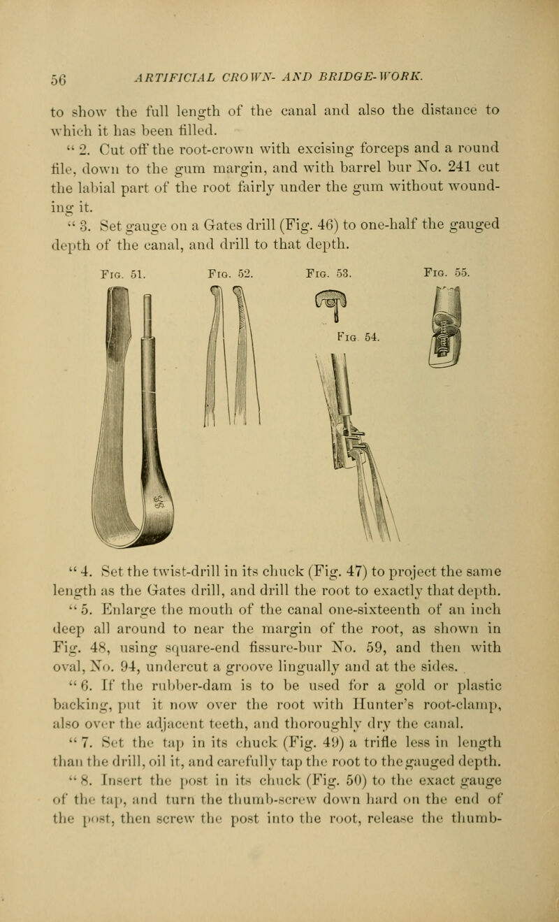 to show the full length of the canal and also the distance to which it has been tilled. •• 2. Cut off the root-crown with excising forceps and a round file, down to the gum margin, and with barrel bur Xo. 241 cut the labial part of the root fairly under the gum without wound- ing it. •• 3. Set gauge on a Gates drill (Fig. 46) to one-half the gauged depth of the canal, and drill to that depth. Fig. 51. Fig. 52. Fig. 53. Fig. 55. Fig 54.  4. Set the twist-drill in its chuck (Fig. 47) to project the same length as the Gates drill, and drill the root to exactly that depth.  5. Enlarge the mouth of the canal one-sixteenth of an inch deep all around to near the margin of the root, as shown in Fig. 48, using square-end fissure-bur No. 59, and then with oval, X<>. 94, undercut a groove lingually and at the sides. 6. It' the rubber-dam is to be used for a gold or plastic backing, put it now over the root with Hunter's root-clamp, also over the adjacent teeth, and thoroughly dry the canal. ••7. 8e1 tin- tap in its chuck (Fig. 49) a trifle less in length than the drill, oil it, and carefully tap the root to the gauged depth. 8. [nsert the post in its chuck (Fig. 50) to the exact gauge of the tap, and turn the thumb-screw down hard on the end of the post, then screw the post into the root, release the thumb-