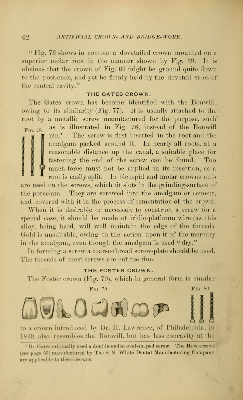 Fio. 78. Fig. 76 shows in contour a dovetailed crown mounted on a superior molar root in the manner shown by Fig. 69. It is obvious that the crown of Fig. 69 might be ground quite down to the post-ends, and yet be firmly held by the dovetail sides of the central cavity. THE GATES CROWN. The Gates crown has become identified with the Bon will, owing to its similarity (Fig. 77). It is usually attached to the root by a metallic screw manufactured for the purpose, such as is illustrated in Fig. 78, instead of the Bonwill pin.1 The screw is first inserted in the root and the amalgam [tacked around it. In nearly all roots, at a reasonable distance up the canal, a suitable place for fastening the end of the screw can be found. Too much force must not be applied in its insertion, as a root is easily split. In bicuspid and molar crowns nuts are used on the screws, which fit slots in the grin ding-surface of the porcelain. They are screwed into the amalgam or cement, and covered with it in the process of cementation of the crown. When it is desirable or necessary to construct a screw for a special case, it should be made of iridio-platinum wire (as this alloy, being hard, will well maintain the edge of the thread). Gold is unsuitable, owing to the action upon it of the mercury in th<- amalgam, even though the amalgam is used dry. In forming ;i screw a coarse-thread screw-plate should be used. The thread- of most screws are cut too fine. THE FOSTER CROWN. The Foster crown (Fig. 79), which in genera] form Fio. 79, to a crown introduced by Dr. II. Lawrence, of Philadelphia, in L849, also resembles-the Bonwill, but has less concavity at the 1 Dr. Qates originally used a double-ended <>\ ul-shnped screw. The H<>w screws (sec | nanufcetared by The s. s. White Dental Manufacturing Company ar applicable t these crowns