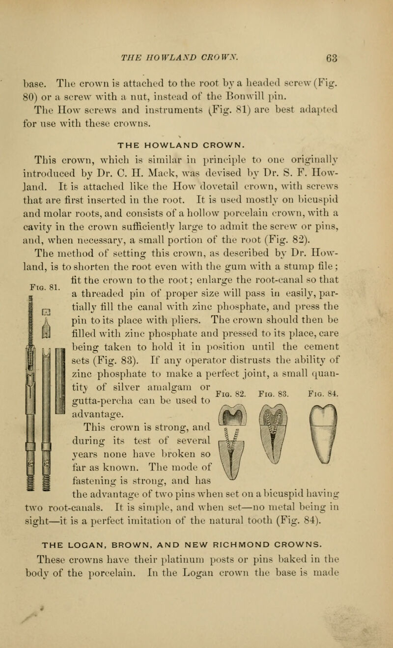 base. The crown is attached to the root by a beaded Bcrew | Fig. 80) or a screw with a nut, instead of the Bonwill pin. The How Bcrews and instruments [Fig. 81) are best adapted for use with these crowns. THE HOWLAND CROWN. This crown, which is similar in principle to one originally introduced by Dr. C. H. Mack, was devised by Dr. S. F. How- land. It is attached like the How dovetail crown, with screws that are first inserted in the root. It is used mostly on bicuspid and molar roots, and consists of a hollow porcelain crown, with a cavity in the crown sufficiently large to admit the screw or pins, and, when necessary, a small portion of the root (Fig. 82). The method of setting this crown, as described by Dr. How- land, is to shorten the root even with the gum with a stump file; fit the crown to the root; enlarge the root-canal so that a threaded pin of proper size will pass in easily, par- tially fill the canal with zinc phosphate, and press the pin to its place with pliers. The crown should then be filled with zinc phosphate and pressed to its place, care being taken to hold it in position until the cement I sets (Fig. 83). If any operator distrusts the ability of zinc phosphate to make a perfect joint, a small quan- tity of silver amalgam or J . . & . Fia. 82. gutta-percha can be used to advantage. This crown is strong, and during its test of several years none have broken so far as known. The mode of fastening is strong, and has the advantage of two pins when set on a bicuspid having two root-canals. It is simple, and when set—no metal being in Fig. 81. ca Fig. 83. Fig. 84. sight—it is a perfect imitation of the natural tooth (Fig. 84). THE LOGAN, BROWN, AND NEW RICHMOND CROWNS. These crowns have their platinum posts or pins baked in the body of the porcelain. In the Logan crown the base is made