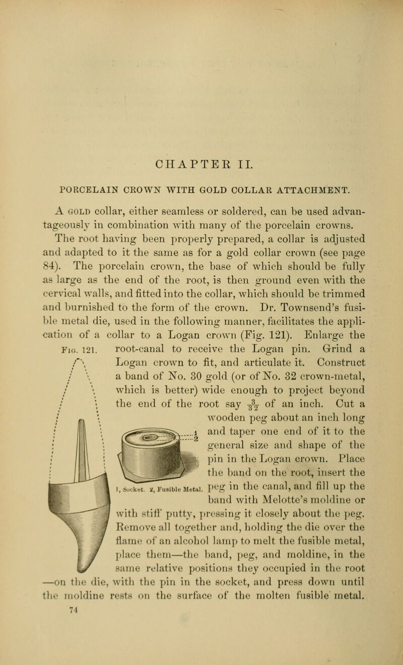 PORCELAIN CROWN WITH GOLD COLLAR ATTACHMENT. A (iOLD collar, either seamless or soldered, can be used advan- tageously in combination with many of the porcelain crowns. The root having been properly prepared, a collar is adjusted and adapted to it the same as for a gold collar crown (see page 84). The porcelain crown, the base of which should be fully as large as the end of the root, is then ground even with the cervical walls, and fitted into the collar, which should be trimmed and burnished to the form of the crown. Dr. Townsend's fusi- ble metal die, used in the following manner, facilitates the appli- cation of a collar to a Logan crown (Fig. 121). Enlarge the Fig. 121. root-canal to receive the Logan pin. Grind a f\ Logan crown to fit, and articulate it. Construct a band of ISTo. 30 gold (or of No. 32 crown-metal, which is better) wide enough to project beyond the end of the root say -fa of an inch. Cut a wooden peg about an inch long and taper one end of it to the general size and shape of the pin in the Logan crown. Place the band on the root, insert the peg in the canal, and fill up the band with Melotte's moldine or with stiff' putty, pressing it closely about the peg. Remove all together and, holding the die over the flame df an alcohol lamp to melt the fusible metal, place them—the band, peg, and moldine, in the same relative positions they occupied in the root —on the die, with the pin in the socket, and press down until the moldine rests on the surface of the molten fusible metal. ■ li-t t, Fusible Metal.