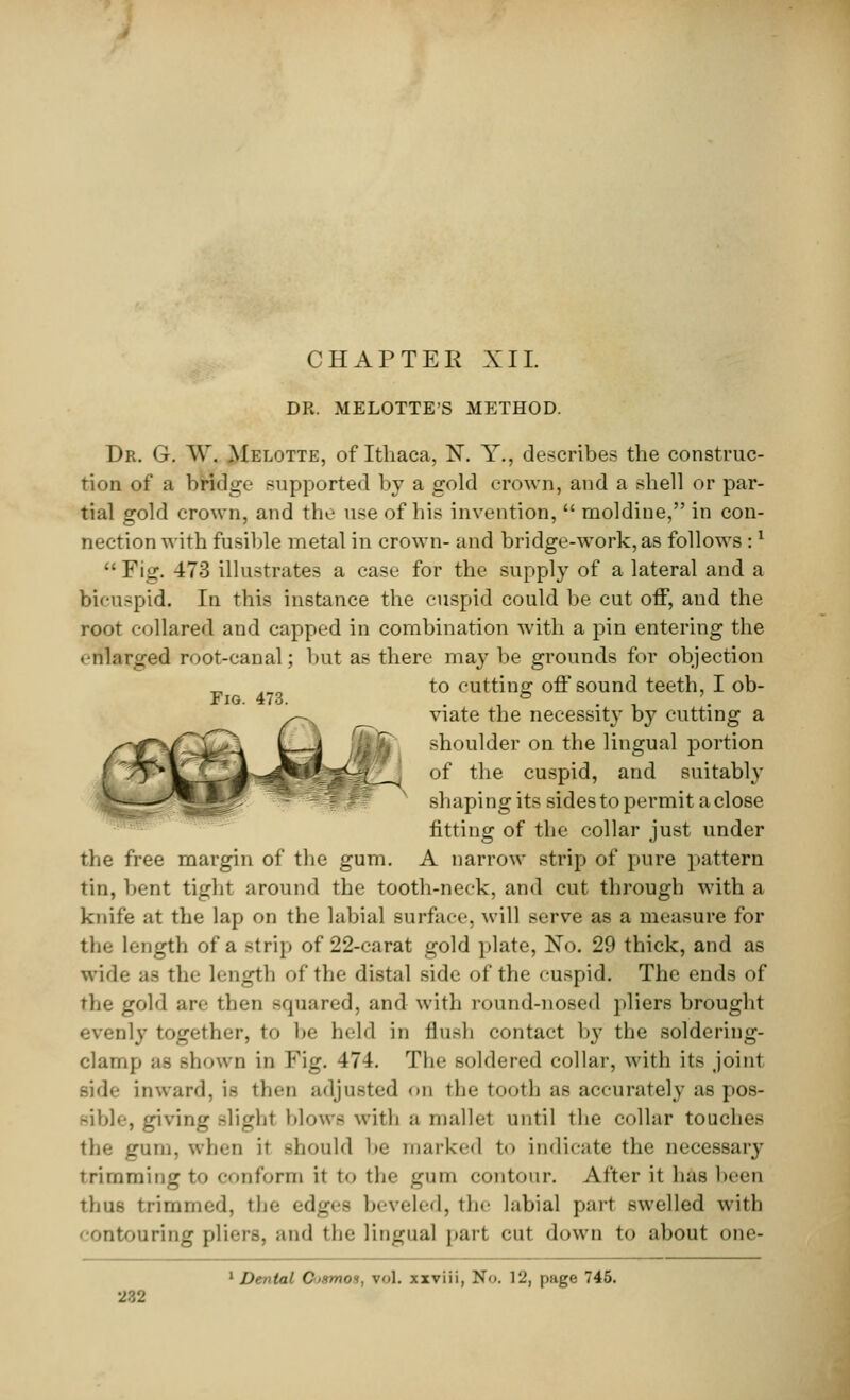 DR. MELOTTE'S METHOD. Dr. G. W, Melotte, of Ithaca, N. Y., describes the construc- tion of a bridge supported by a gold crown, and a shell or par- tial gold crown, and the use of his invention,  moldine, in con- nection with fusible metal in crown- and bridge-work, as follows :l  Fig. 473 illustrates a case for the supply of a lateral and a bicuspid. In this instance the cuspid could be cut off, and the root collared and capped in combination with a pin entering the enlarged root-canal; but as there may be grounds for objection ^ ,„„ to cutting off sound teeth, I ob- Fig. 473. . & . '. viate the necessity by cutting a shoulder on the lingual portion of the cuspid, and suitably shaping its sides to permit a close fitting of the collar just under the free margin of the gum. A narrow strip of pure pattern tin, bent tight around the tooth-neck, and cut through with a knife at the lap on the labial surface, will serve as a measure for the length of a strip of 22-carat gold plate, No. 29 thick, and as wide as the length of the distal side of the cuspid. The ends of the gold are then squared, and with round-nosed pliers brought nly together, to be held in flush contact by the soldering- clamp ae shown in Fig. 474. The soldered collar, with its joint inward, is then adjusted OD the tooth as accurately as pos- sible, giving -light blow- with a mallet until the collar touches the gum, when it -hould be marked to indicate the necessary trimming to conform it to the gum contour. After it has been thus trimmed, the edges beveled, the labial part swelled with contouring pliers, and the lingual part cut down to about one- 1 Dental C-ismoa, vol. xxviii, No. 12, page 745.