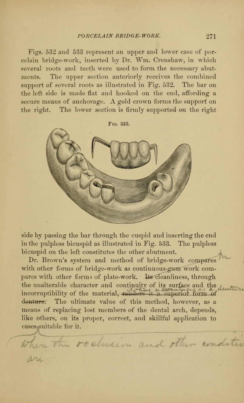 Figs. 532 and 533 represent an upper and lower case of por- celain bridge-work, inserted by Dr. Wm. Crenshaw, in which several roots and teeth were used to form the necessary abut- ments. The upper section anteriorly receives the combined support of several roots as illustrated in Fig. 532. The bar on the left side is made flat and hooked on the end, affording a secure means of anchorage. A gold crown forms the support on the right. The lower section is firmly supported on the right Fig. 533. side by passing the bar through the cuspid and inserting the end in the pulpless bicuspid as illustrated in Fig. 533. The pulpless bicuspid on the left constitutes the other abutment. Dr. Brown's system and method of bridge-work compares with other forms of bridge-work as continuous-gum work com- pares with other form? of plate-work. Its cleanliness, through the unalterable character and continuity of its sur&ce and the incorruptibility of the material, rwnde-*'fl it ,a'Superior form of d^wtaw. The ultimate value of this method, however, as a means of replacing lost members of the dental arch, depends, like others, on its proper, correct, and skillful application to casesc.suitable for it. u- tXx\.t- ;■