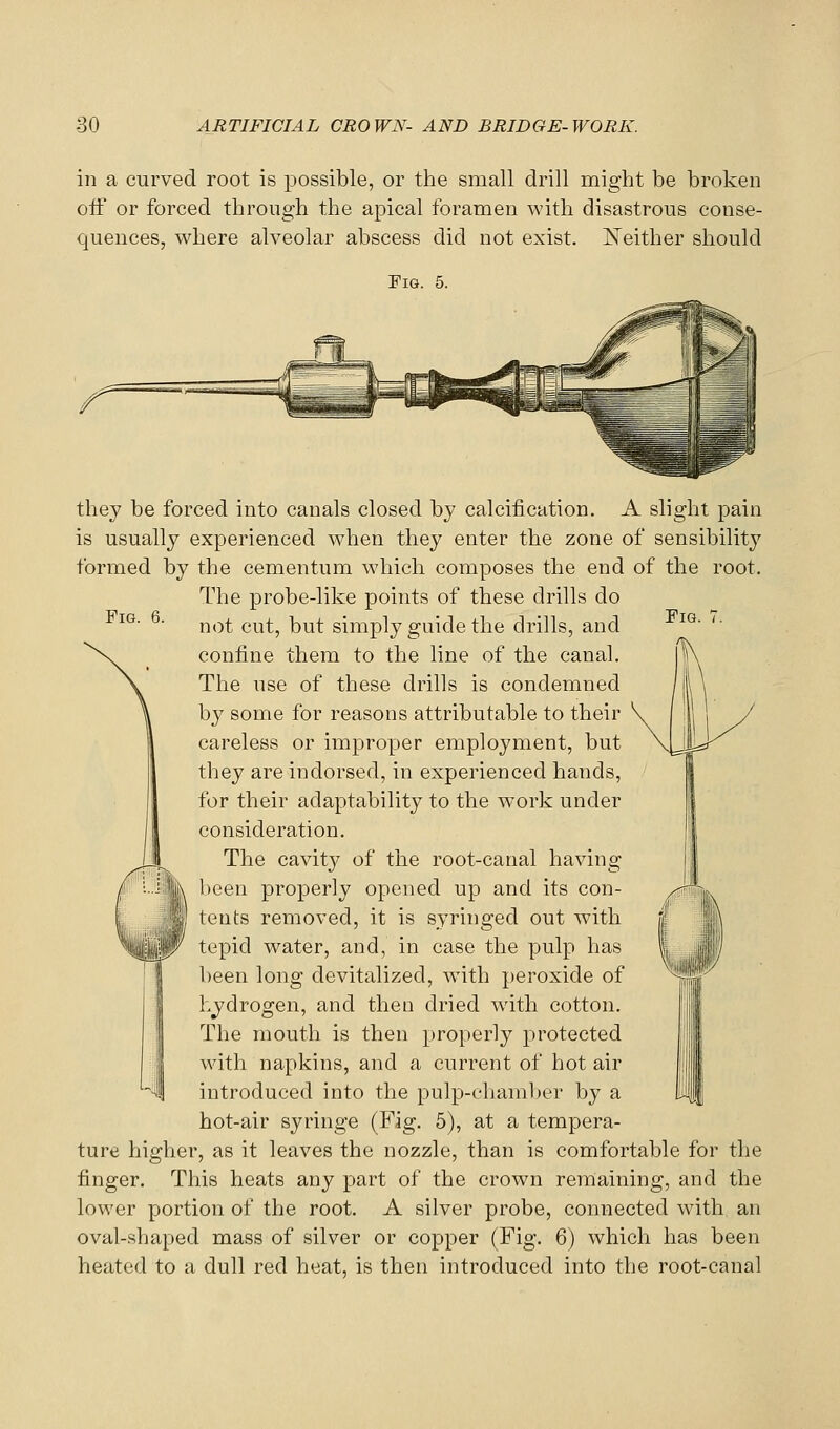 in a curved root is possible, or the small drill might be broken oif or forced through the apical foramen with disastrous conse- quences, where alveolar abscess did not exist. ISTeither should Fig. 5. Fig. 6. Fig. 7. they be forced into canals closed by calcification. A slight pain is usually experienced when they enter the zone of sensibility formed by the cementum which composes the end of the root. The probe-like points of these drills do not cut, but simply guide the drills, and confine them to the line of the canal. The use of these drills is condemned by some for reasons attributable to their careless or improper employment, but they are indorsed, in experienced hands, for their adaptability to the w^ork under consideration. The cavity of the root-canal having l)een properly opened up and its con- tents removed, it is syringed out with tepid water, and, in case the pulp has been long devitalized, wdth peroxide of I Ivydrogen, and then dried with cotton. The mouth is then properly protected with napkins, and a current of hot air introduced into the pulp-chamber by a hot-air syringe (Fig. 5), at a tempera- ture higher, as it leaves the nozzle, than is comfortable for the finger. This heats any part of the crown remaining, and the lower portion of the root. A silver probe, connected wdth an oval-shaped mass of silver or copper (Fig. 6) which has been heated to a dull red heat, is then introduced into the root-canal