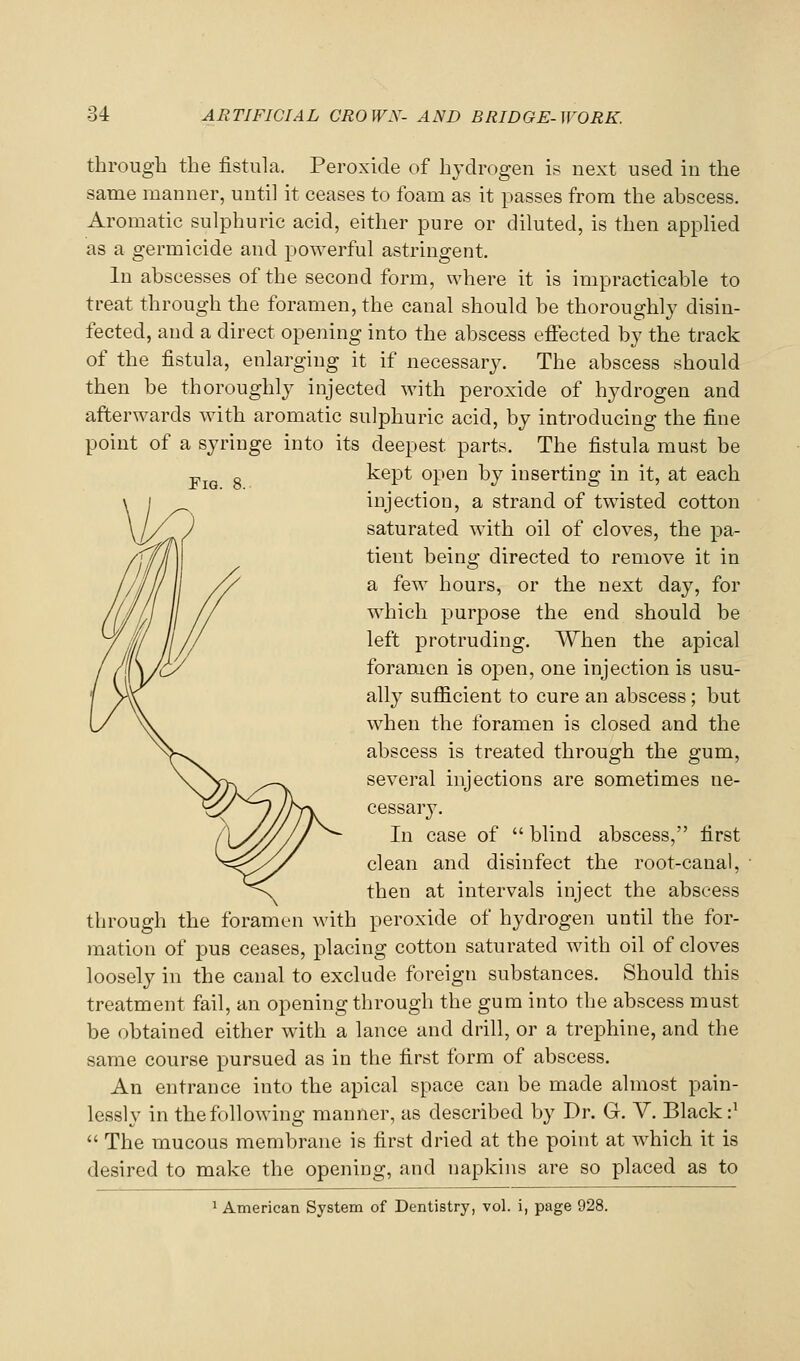 through the fistula. Peroxide of hydrogen is next used in the same manner, until it ceases to foam as it passes from the abscess. Aromatic sulphuric acid, either pure or diluted, is then applied as a germicide and powerful astringent. In abscesses of the second form, where it is impracticable to treat through the foramen, the canal should he thoroughly disin- fected, and a direct opening into the abscess effected by the track of the fistula, enlarging it if necessary. The abscess should then be thoroughly injected with peroxide of hydrogen and afterwards with aromatic sulphuric acid, by introducing the fine point of a syringe into its deepest parts. The fistula must be kept open by inserting in it, at each injection, a strand of twisted cotton saturated with oil of cloves, the pa- tient being directed to remove it in a few hours, or the next day, for which purpose the end should be left protruding. When the apical foramen is open, one injection is usu- ally sufi&cient to cure an abscess; but when the foramen is closed and the abscess is treated through the gum, several injections are sometimes ne- cessary. In case of  blind abscess, first clean and disinfect the root-canal, then at intervals inject the abscess through the foramen with peroxide of hydrogen until the for- mation of pus ceases, placing cotton saturated with oil of cloves loosely in the canal to exclude foreign substances. Should this treatment fail, an opening through the gum into the abscess must be obtained either with a lance and drill, or a trephine, and the same course pursued as in the first form of abscess. An entrance into the apical space can be made almost pain- lessly in the following manner, as described by Dr. G. V. Black:'  The mucous membrane is first dried at the point at which it is desired to make the opening, and napkins are so placed as to