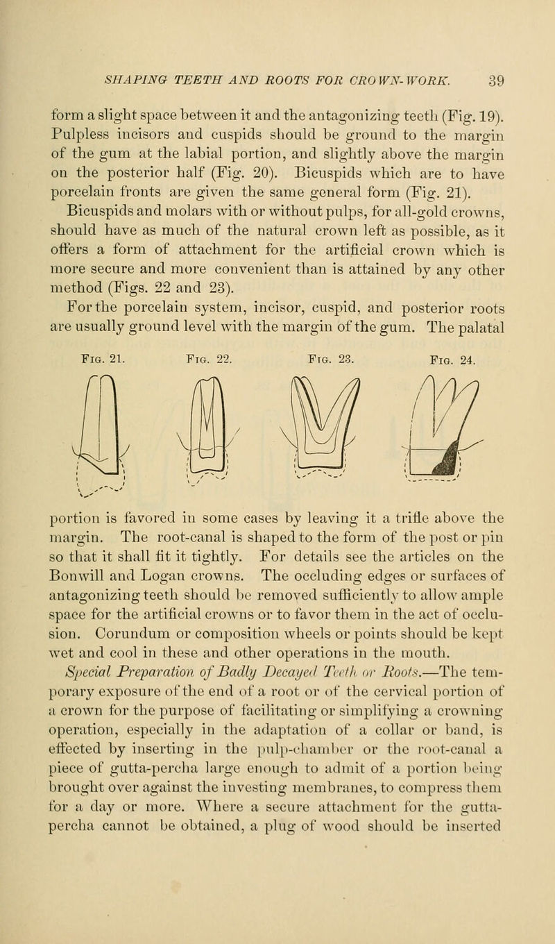 form a slight space between it and the antagonizing teeth (Fig. 19). Pulpless incisors and cuspids should be ground to the margin of the gum at the labial portion, and slightly above the margin on the posterior half (Fig. 20). Bicuspids which are to have porcelain fronts are given the same general form (Fig. 21). Bicuspids and molars with or without pulps, for all-gold crowns, should have as much of the natural crown left as possible, as it offers a form of attachment for the artificial crown which is more secure and more convenient than is attained by any other method (Figs. 22 and 23). For the porcelain system, incisor, cuspid, and posterior roots are usually ground level with the margin of the gum. The palatal Fig. 21. Ftg. 22. Fig. 23. Fig. 24. portion is favored in some cases by leaving it a triiie above the margin. The root-canal is shaped to the form of the post or pin so that it shall fit it tightly. For details see the articles on the Bon will and Logan crowns. The occluding edges or surfaces of antagonizing teeth should be removed sufficiently to allow ample space for the artificial crowns or to favor them in the act of occlu- sion. Corundum or composition wheels or points should be kept wet and cool in these and other operations in the mouth. Special Preparation of Badly Decayed Teeth or Hoots.—The tem- porary exposure of the end of a root or of the cervical portion of a crown for the purpose of facilitating or simplifying a crowning operation, especially in the adaptation of a collar or band, is ettected by inserting in the ])ulp-chamber or the root-canal a piece of gutta-percha large enough to admit of a portion being brought over against the investing membranes, to compress them for a day or more. Where a secure attachment for the gutta- percha cannot be obtained, a plug of wood should be inserted