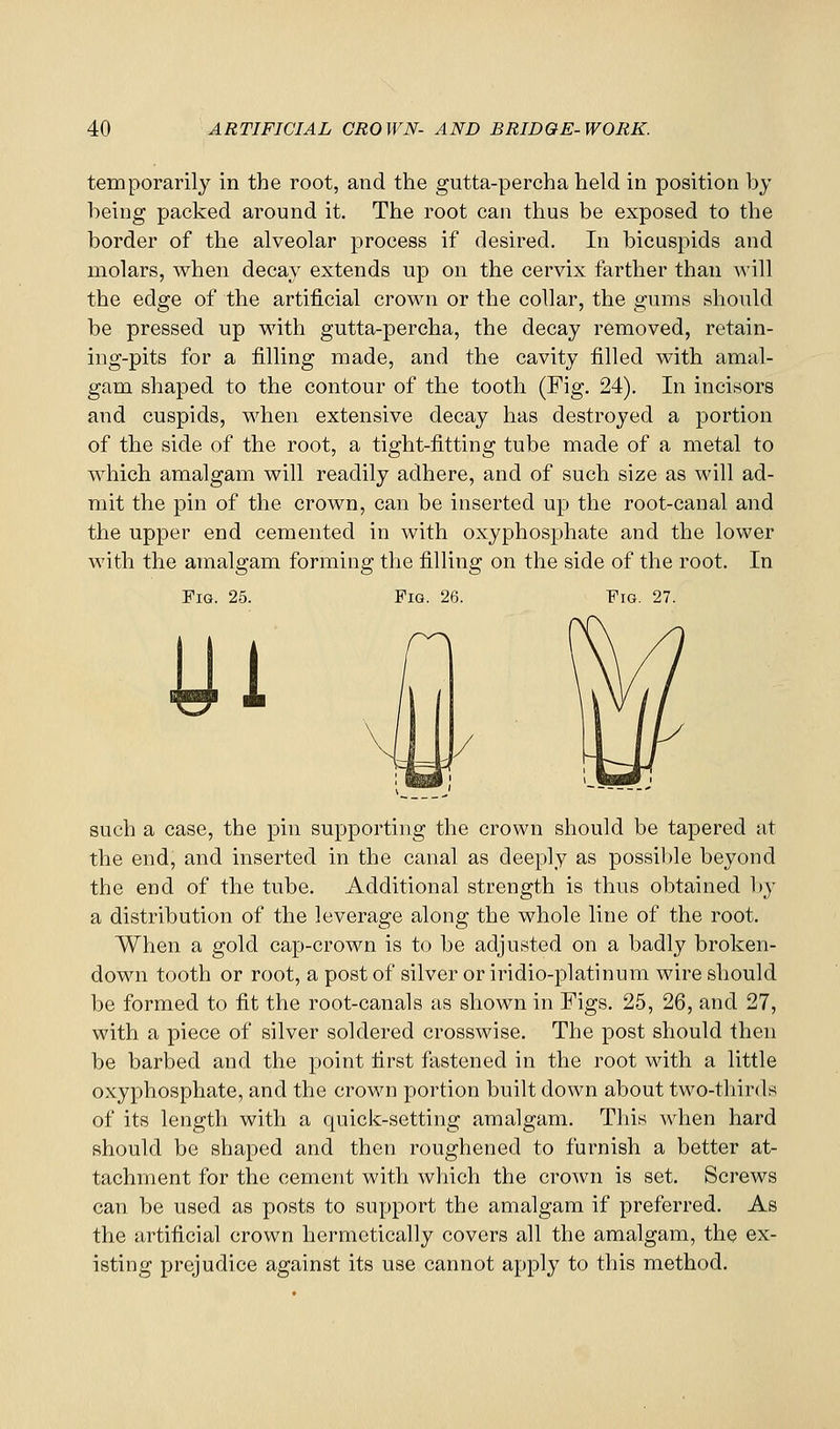 temporarily in the root, and the gutta-percha held in position bj being packed around it. The root can thus be exposed to the border of the alveolar process if desired. In bicuspids and molars, when decay extends up on the cervix farther than will the edge of the artificial crown or the collar, the gums should be pressed up with gutta-percha, the decay removed, retain- ing-pits for a filling made, and the cavity filled with amal- gam shaped to the contour of the tooth (Fig. 24). In incisors and cuspids, when extensive decay has destroyed a portion of the side of the root, a tight-fitting tube made of a metal to which amalgam will readily adhere, and of such size as will ad- mit the pin of the crown, can be inserted up the root-canal and the upper end cemented in with oxyphosphate and the lower with the amalgam forming the filling on the side of the root. In Fig. 25. Fig. 26. Fig. 27. Ui such a case, the pin supporting the crown should be tapered at the end, and inserted in the canal as deeply as possible beyond the end of the tube. Additional strength is thus obtained ])y a distribution of the leverage along the whole line of the root. When a gold cap-crown is to be adjusted on a badly broken- down tooth or root, a post of silver or iridio-platinum wire should be formed to fit the root-canals as shown in Figs, 25, 26, and 27, with a piece of silver soldered crosswise. The post should then be barbed and the point first fastened in the root with a little oxyphosphate, and the crown portion built down about two-thirds of its length with a quick-setting amalgam. This when hard should be shaped and then roughened to furnish a better at- tachment for the cement with which the cro^vn is set. Screws can be used as posts to support the amalgam if preferred. As the artificial crown hermetically covers all the amalgam, the ex- isting prejudice against its use cannot apply to this method.