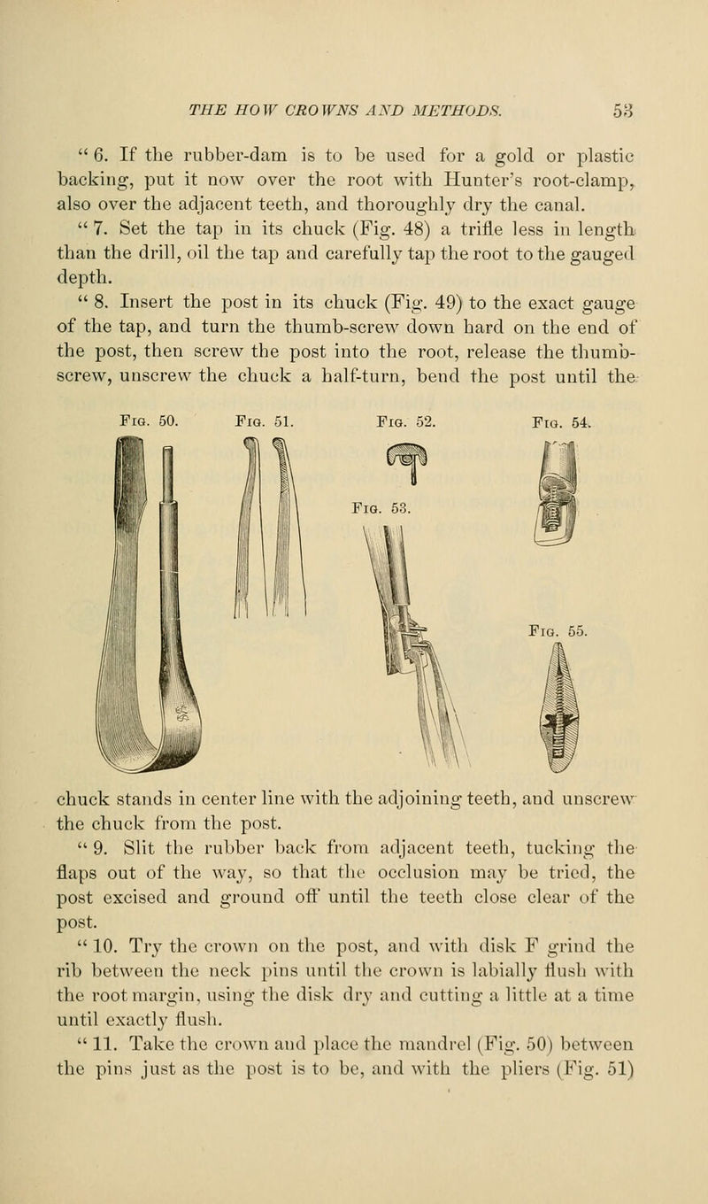 6. If the rubber-dam is to be used for a gold or plastic backing, put it now over the root with Hunter's root-clamp, also over the adjacent teeth, and thoroughly dry the canal. 7. Set the tap in its chuck (Fig. 48) a trifle less in length than the drill, oil the tap and carefully tap the root to the gauged depth. 8. Insert the post in its chuck (Fig, 49) to the exact gauge of the tap, and turn the thumb-screw down hard on the end of the post, then screw the post into the root, release the thumb- screw, unscrew the chuck a half-turn, bend the post until the Fig. 50. FiQ. 51. Fig. 52. Fig. 54. Fig. 53. Fig. 55. chuck stands in center line with the adjoining teeth, and unscrew the chuck from the post. 9. Slit the rubber back from adjacent teeth, tucking the flaps out of the way, so that the occlusion may be tried, the post excised and ground ofl until the teeth close clear of the post. 10. Try the crown on the post, and with disk F grind the rib between the neck pins until the crown is labially flush with the root margin, using the disk dry and cutting a little at a time until exactly flush. 11. Take the crown and place the mandrel (Fig. 50) between the pins just as the post is to be, and with the pliers (Fig. 51)