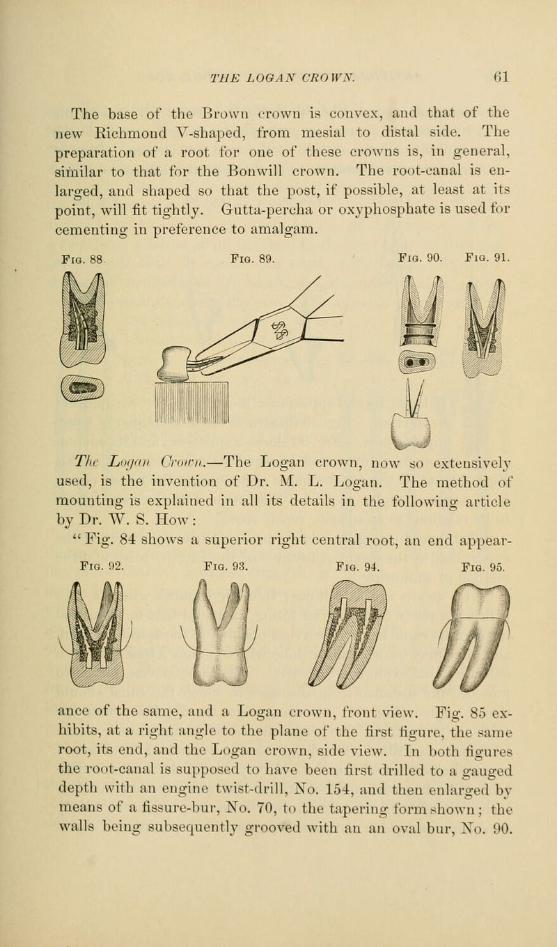 The base of the Brown crown is convex, and that of the new Eichmond Y-shaped, from mesial to distal side. The preparation of a root for one of these crowns is, in general, sihiilar to that for the Bonwill crown. The root-canal is en- larged, and sliaped so that the post, if possible, at least at its point, will fit tightly. Gutta-percha or oxyphosphate is used for cementing in preference to amalgam. Pig. 88 Fig. 89. Fig. 90. Fig. 91. The Lixidii Crnirii.—The Logan crown, now so extensively used, is the invention of Dr. M. L. Logan. The method of mounting is explained in all its details in the following article by Dr. W. S. How :  Fig. 84 shows a superior right central root, an end appear- Fig. n2. Fig. 93. Fig. 94. Fig. 95. ance of the same, and a Logan crown, front view. Fig. 85 ex- hibits, at a right angle to the plane of the first figure, the same root, its end, and the Logan crown, side view. In both figures the root-canal is supposed to have been first drilled to a gauged depth with an engine twist-drill. No. 154, and then enlarged by means of a fissure-bur, No. 70, to the tapering form shown; the walls being subsequently grooved with an an oval bur, No. 90.