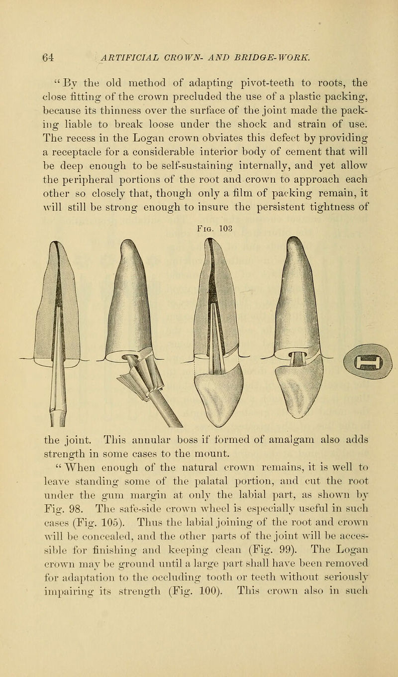  By the old method of adapting pivot-teeth to roots, the close fitting of the crown precluded the use of a plastic packing, because its thinness over the surface of the joint made the pack- ing liable to break loose under the shock and strain of use. The recess in the Logan crown obviates this defect by providing a receptacle for a considerable interior body of cement that will be deep enough to be self-sustaining internally, and yet allow the peripheral portions of the root and crown to approach each other so closely that, though only a film of packing remain, it will still be strong enough to insure the persistent tightness of Fig. 103 the joint. This annular boss if formed of amalgam also adds strength in some cases to the mount.  When enough of the natural crown remains, it is well to leave standing some of the palatal portion, and cut the root under the gum margin at only the labial part, as shown by Fig. 98. The safe-side crown Avheel is especially useful in such cases (Fig. 105). Thus the lal)ial joining of the root and crown will be concealed, and the other parts of the joint will be acces- sible for finishing and keeping clean (Fig. 99). The Logan crown may be ground until a large part shall have been removed for ada|)tation to the occluding tooth or teeth without seriously impairing its strength (Fig. 100). This crown also in such