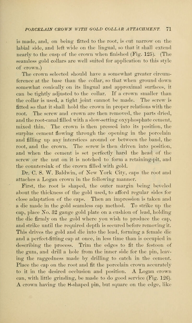 is made, and, on l)eing fitted to the root, is cut narrow on the labial side, and left wide on the linarual, so that it shall extend nearly to the cusp of the crown when finished (Fig. 125). (The seamless gold collars are well suited for application to this style of crown.) The crown selected should liave a somewhat greater circum- ference at the base than the collar, so that Avhen ground down somewhat conically on its lingual and approximal surfaces, it can V)e tightly adjusted to the collar. If a crown smaller tlian the collar is used, a tight joint cannot he made. The screw is fitted so that it shall hold the crown in proper relations with the root. The screw and crown are then removed, the parts dried, and the root-canal filled with a slow-setting ox}^3hosphate cement, mixed thin. The crown is then pressed into its position, the surplus cement flowing through the opening in the porcelain and filling up any interstices around or between the band, the root, and the crown. The screw is then driven into position, and when the cement is set perfectly hard the head of the screw or the nut on it is notched to form a retaining-pit, and the countersink of the crown filled with gold. Dr. C. S. W. Baldwin, of IS'ew York City, caps the root and attaclies a Logan crown in the following manner. First, the root is shaped, the (juter margin being beVL-led al)Out tile thickness of the gold used, to aftbrd regular sides foi close ada})tation of the caps. Then an impression is taken and a die made in the gold seamless cap method. To strike up the cap, place Xo. 32 gauge gold plate on a cushion of lead, holding the die firndy on the gold where you wish to produce the cap, and strike until the recpiired depth is secured before remo\'ing it. This drives the gold and die into the lead, forming a female die and a perfect-fitting cap at once, in less time than is occupied in describing the process. Trim the edges to fit the festoon of the gum. and drill a hole from the inner side \'ov the pin, leav- ing the raggedness made l)y drilling to catch in the cement. Place the ca}) on the root and fit the }iorcelain crown accurately to it in the desired occlusion and position. A Logan erown can, with little grinding, be made to do good service (Fig. 126). A crown having the H-sha[ied pin, but scpiare on the edge, Hke