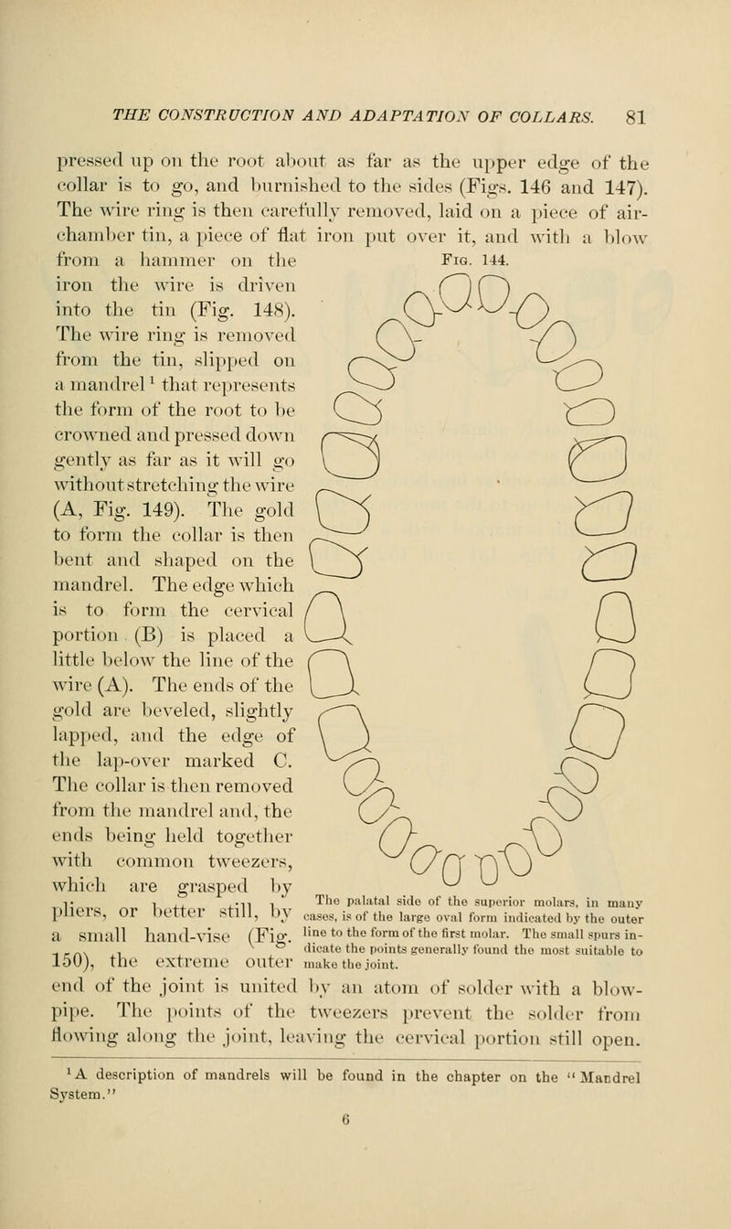 pressed up on tlu' root about as far as the upper edge of the collar is to go, and l)uniishc'd to the sides (Figs. 146 and 147). The wire ring is then earefnlly removed, laid on a piece of air- chand)er tin, a piece of flat iron put over it, and with a blow from a hammer on the Fig. 144. iron the wire is driven into the tin (Fig. 148). The wire ring is removed from the tin, slipped on a mandrel ^ that represents the form of the root to l)e crowned and pressed down gently as far as it will go without stretching the wire (A, Fig. 149). The gold to form the collar is then ^-.^^^ bent and shaped on the \ ^^ mandrel. The edge which is to form the cervical portion (B) is placed a little below the line of the wire (A). The ends of the gold are l)eveled, slightly lapped, and the edge of the lap-over marked C. The collar is then removed from the mandrel and, the ends being held together with common tweezers, which are grasped l)y y ^ 1+4- f'11 1  '^'^ palatal sido of the superior molars, in many pners, or Detter still, by cases, is of the largo oval form indicated by the outer a small hand-\ise (Fig. I'^e to the formofthe first molar. The small spurs in- ^ ^, , \ &• dicate the points generally found the most suitable to 15U), tllC extreme outer make the joint. end of the Joint is united l)y an atom of solder with a blow- pipe. The j)oints of the tweezers prevent the solder from flowing along the joint, leaving the cervical portion still open. ^A description of mandrels will be found in the chapter on the Mandrel System. 6