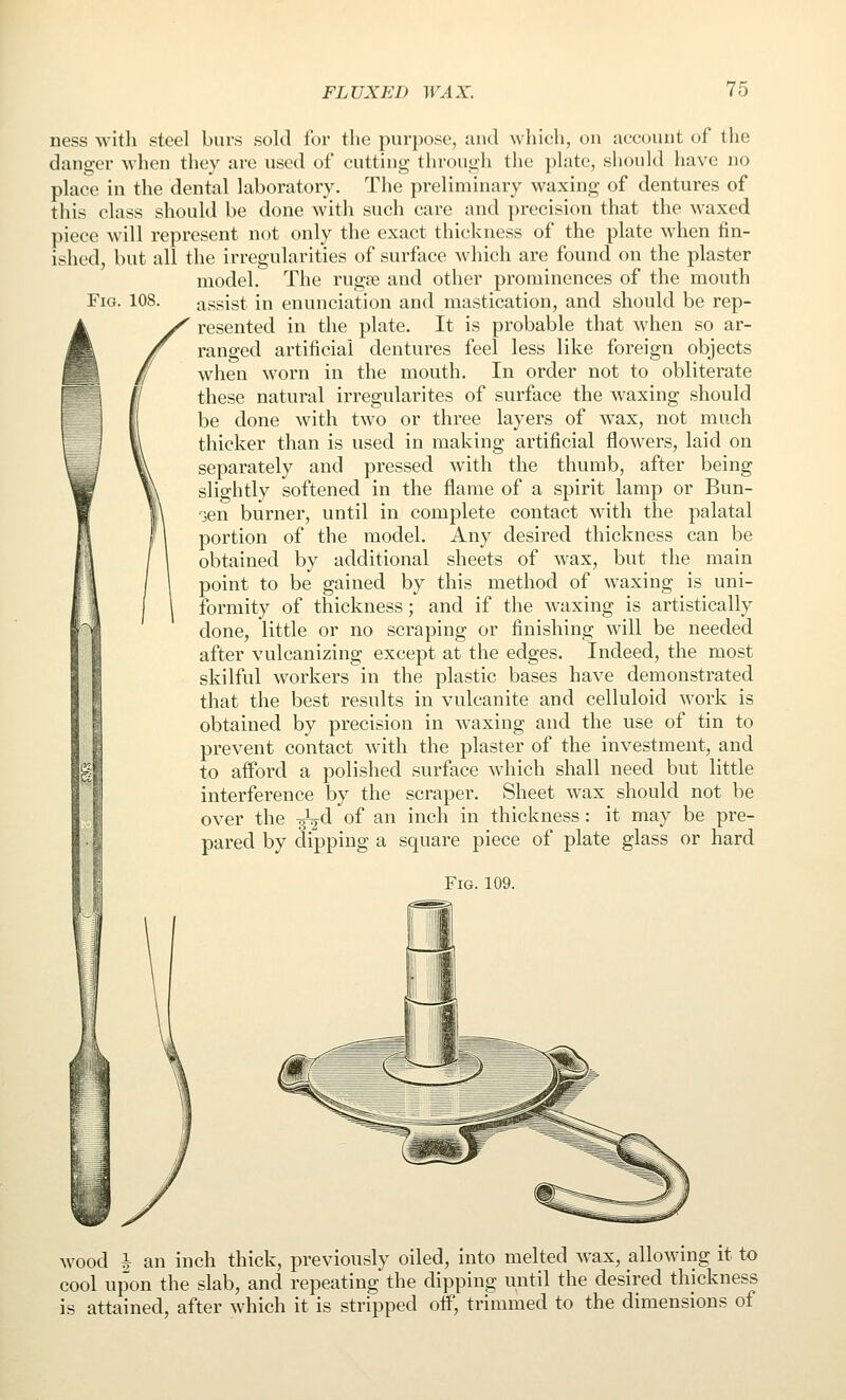 ness with steel burs sold for the purpose, and which, on account of the danger when they are used of cutting through tlie ])late, should have no place in the dental laboratory. Tlie preliminary waxing of dentures of this class should be done with such care and precision that the waxed piece will represent not only the exact thickness of the plate when fin- ished, but all the irregularities of surface which are found on the plaster model. The rugse and other prominences of the mouth Fig. 108. assist in enunciation and mastication, and should be rep- Ay^ resented in the plate. It is probable that when so ar- jf ranged artificial dentures feel less like foreign objects / when worn in the mouth. In order not to obliterate these natural irregularites of surface the waxing should be done with two or three layers of wax, not much thicker than is used in making artificial flowers, laid on separately and pressed with the thumb, after being slightly softened in the flame of a spirit lamp or Bun- 'jen burner, until in complete contact with the palatal portion of the model. Any desired thickness can be obtained by additional sheets of wax, but the main point to be gained by this method of waxing is uni- formity of thickness; and if the waxing is artistically done, little or no scraping or finishing will be needed after vulcanizing except at the edges. Indeed, the most skilful workers in the plastic bases have demonstrated that the best results in vulcanite and celluloid work is obtained by precision in waxing and the use of tin to prevent contact with the plaster of the investment, and to aflbrd a polished surface which shall need but little interference by the scraper. Sheet wax should not be over the ^^2^d of an inch in thickness: it may be pre- pared by dipping a square piece of plate glass or hard Fig. 109. wood I an inch thick, previously oiled, into melted wax, allowing it to cool upon the slab, and repeating the dipping until the desired thickness is attained, after which it is stripped off, trimmed to the dimensions of